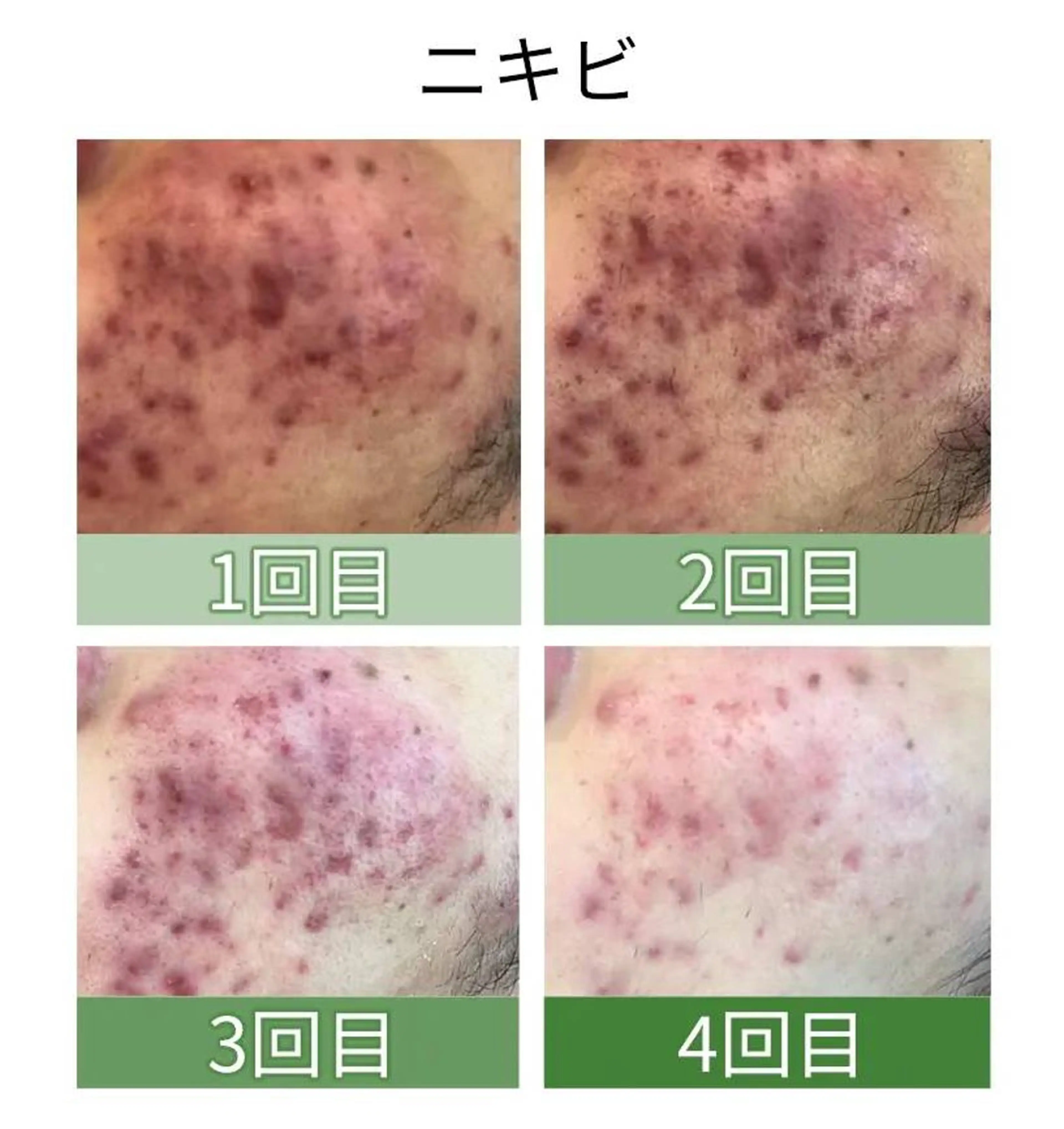 エステ MyFairLady miuのエステ・リラクイメージ