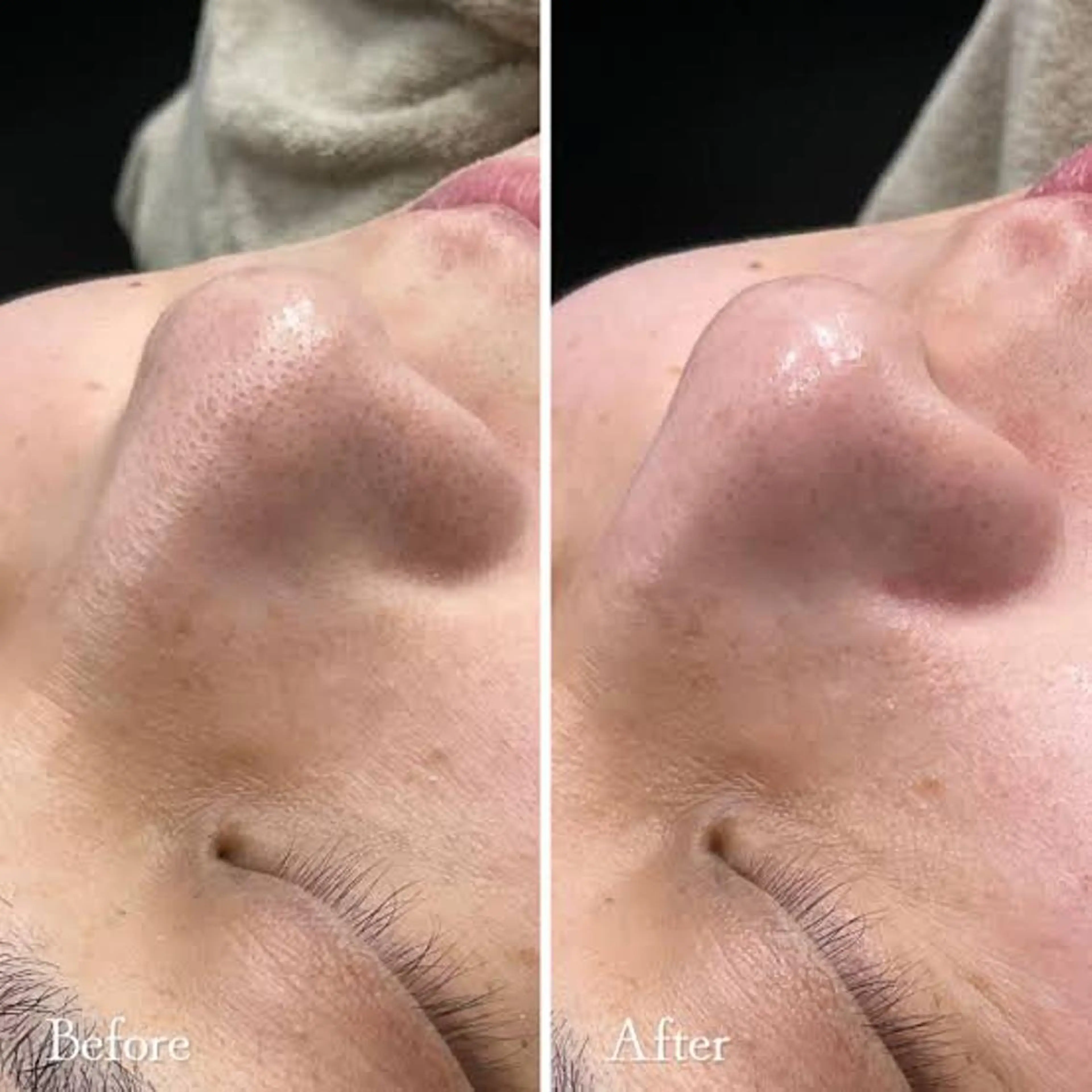 Luana武蔵小杉店 (ルアナ)の眉毛・アイブロウイメージ