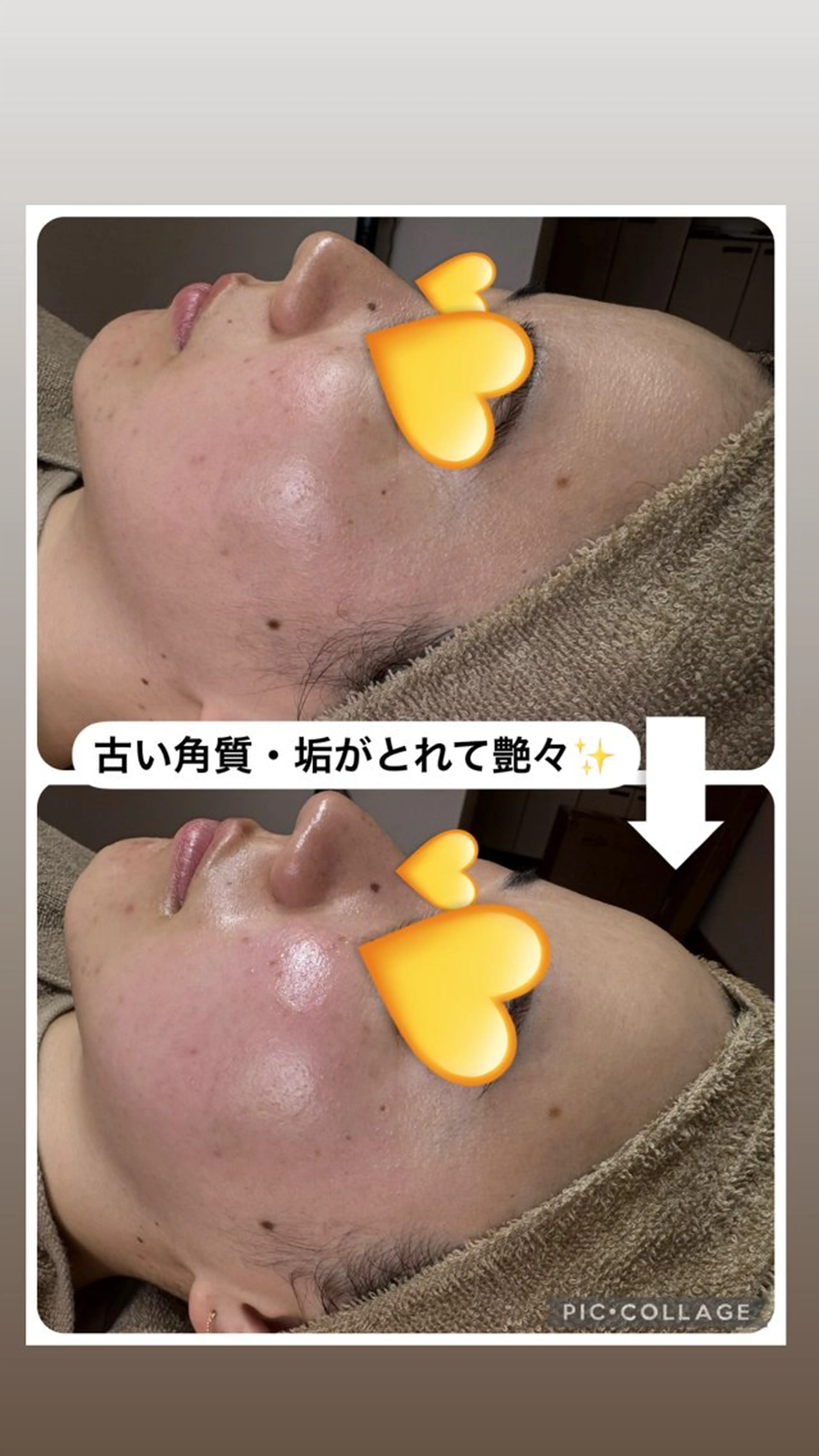 W MISATOのエステ・リラクイメージ