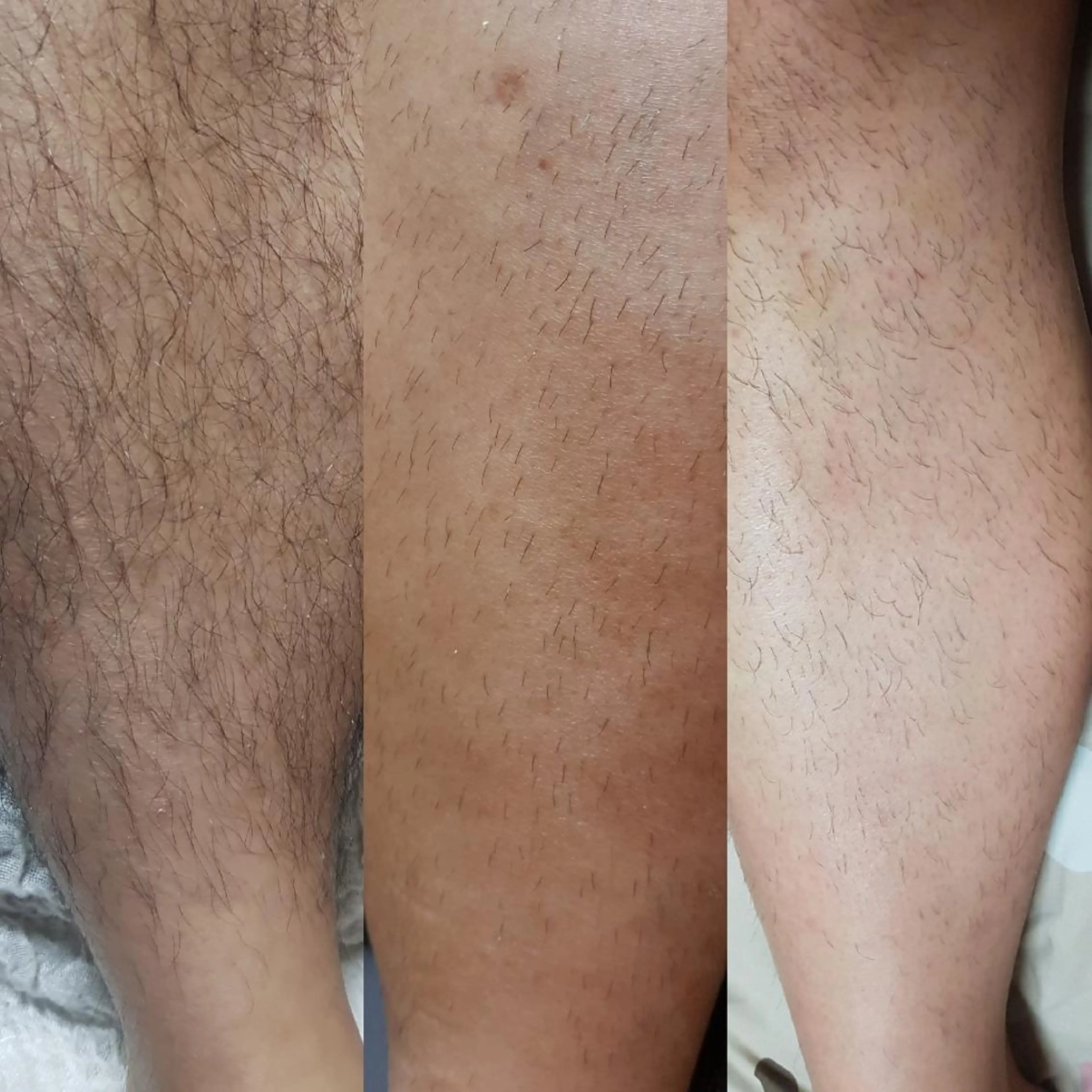 メンズ 脱毛 林 茉美のマツエク・マツパデザイン