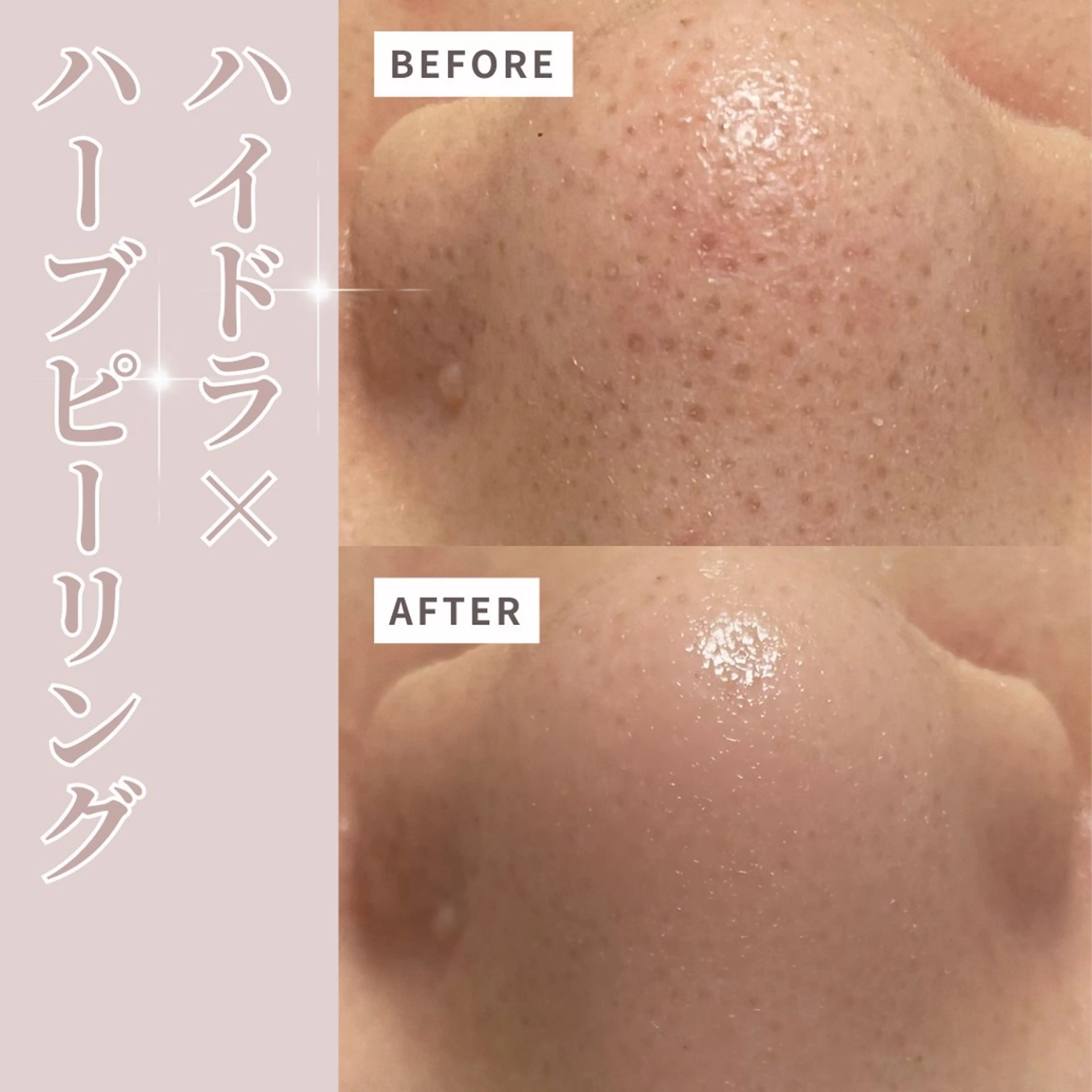 エステ プライベートサロン Belle(ベル)のエステ・リラクイメージ