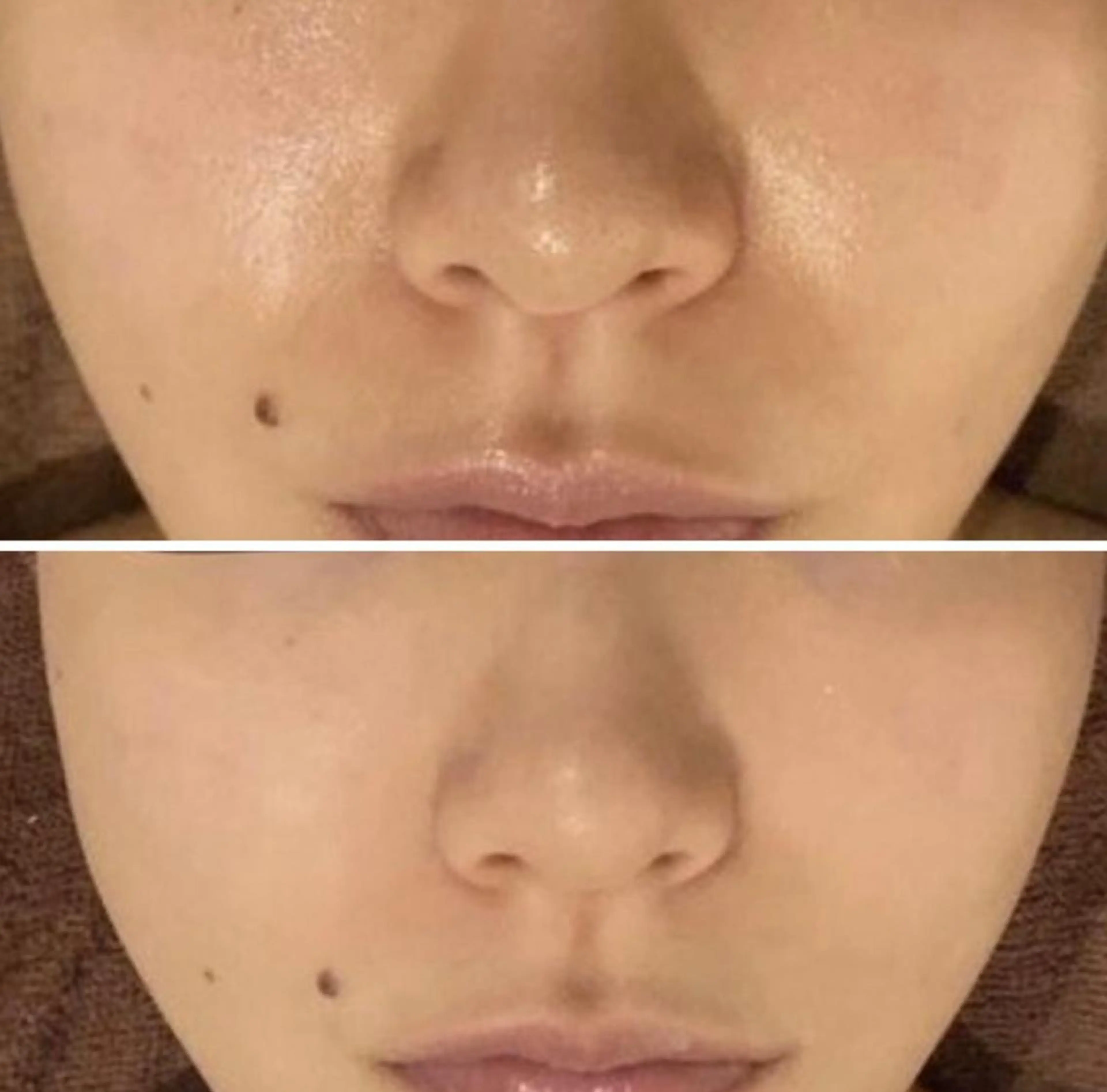 セミロング カラー パーマ ヘアアレンジ メンズ キッズ ネイル マツエク・マツパ アイブロウ 3か月で肌革命👼 ニキビ専門店💫のエステ・リラクイメージ