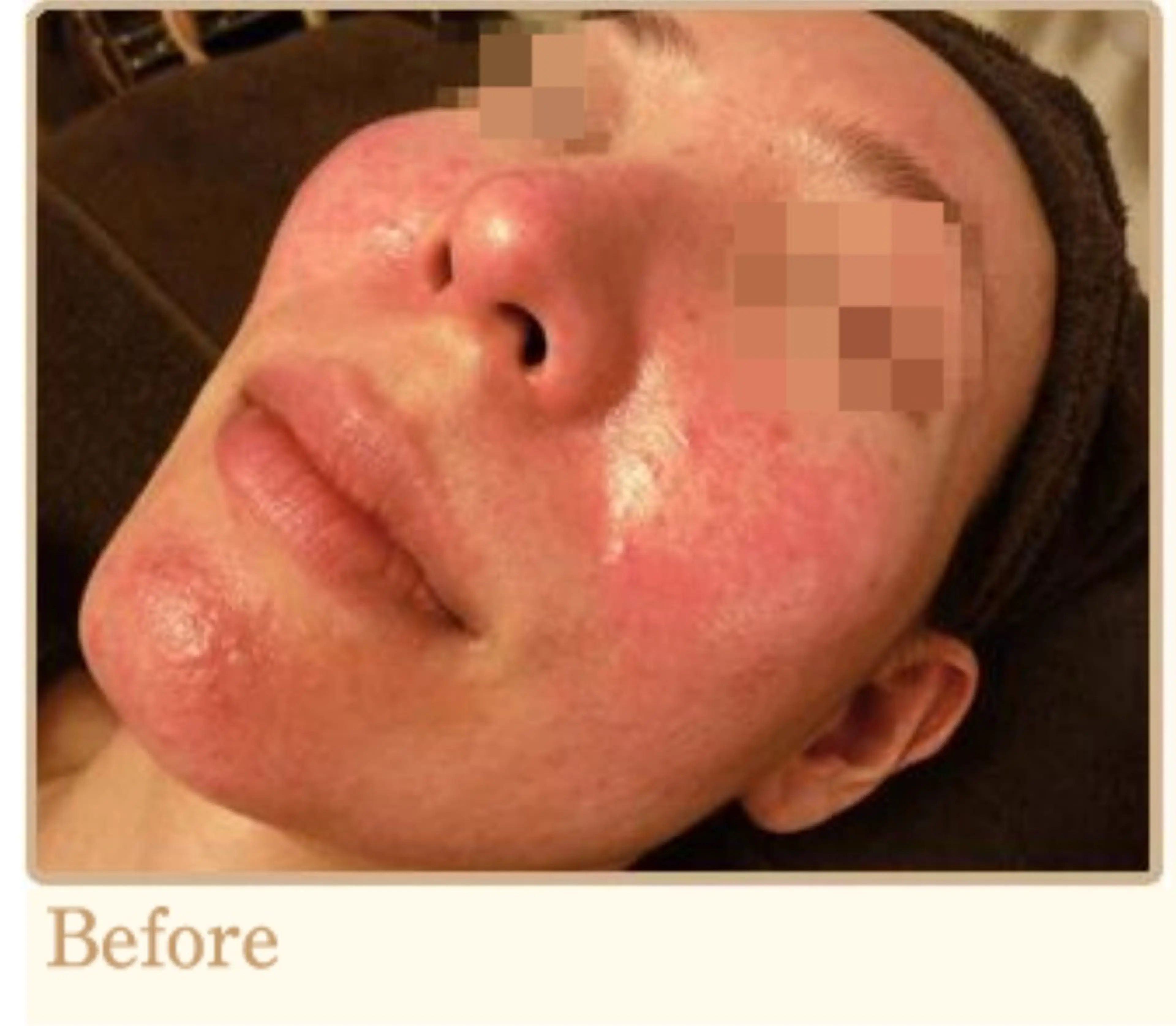 ピーリングサロン シャンテールのエステ・リラクイメージ