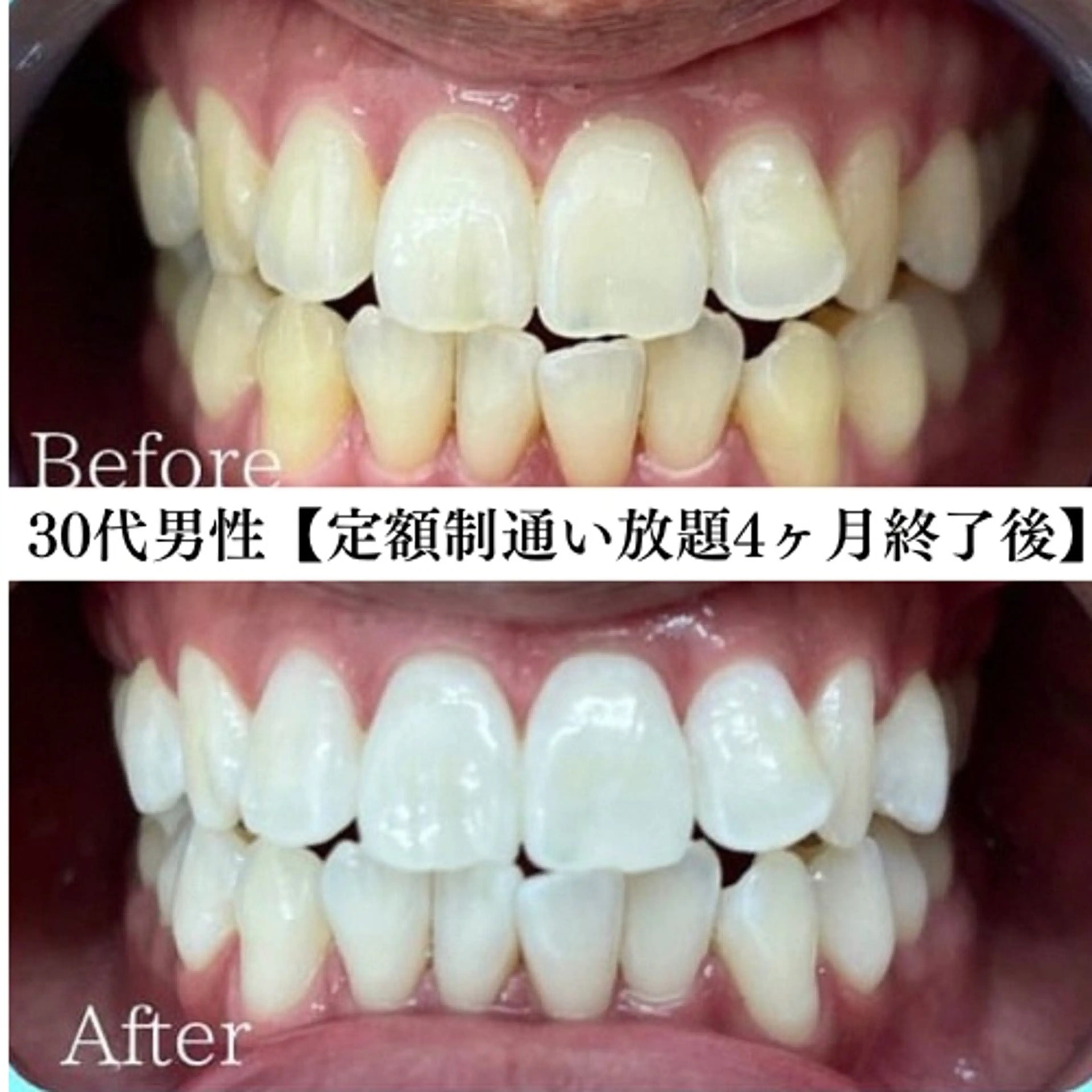 キッズ メンズ エステ リラク セルフホワイトニング WHITE福岡天神店のエステ・リラクイメージ