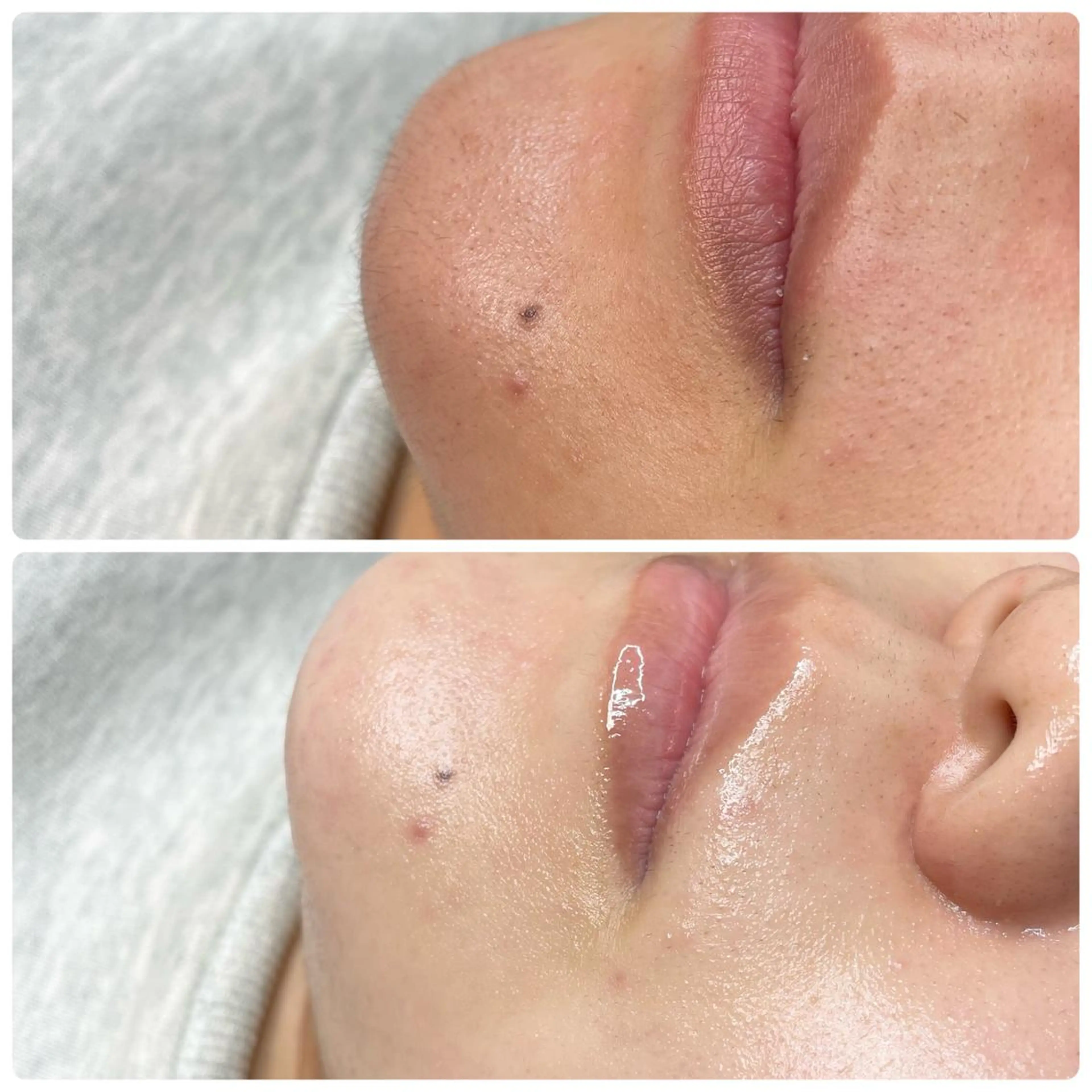 セミロング 代表 MOMOのエステ・リラクイメージ