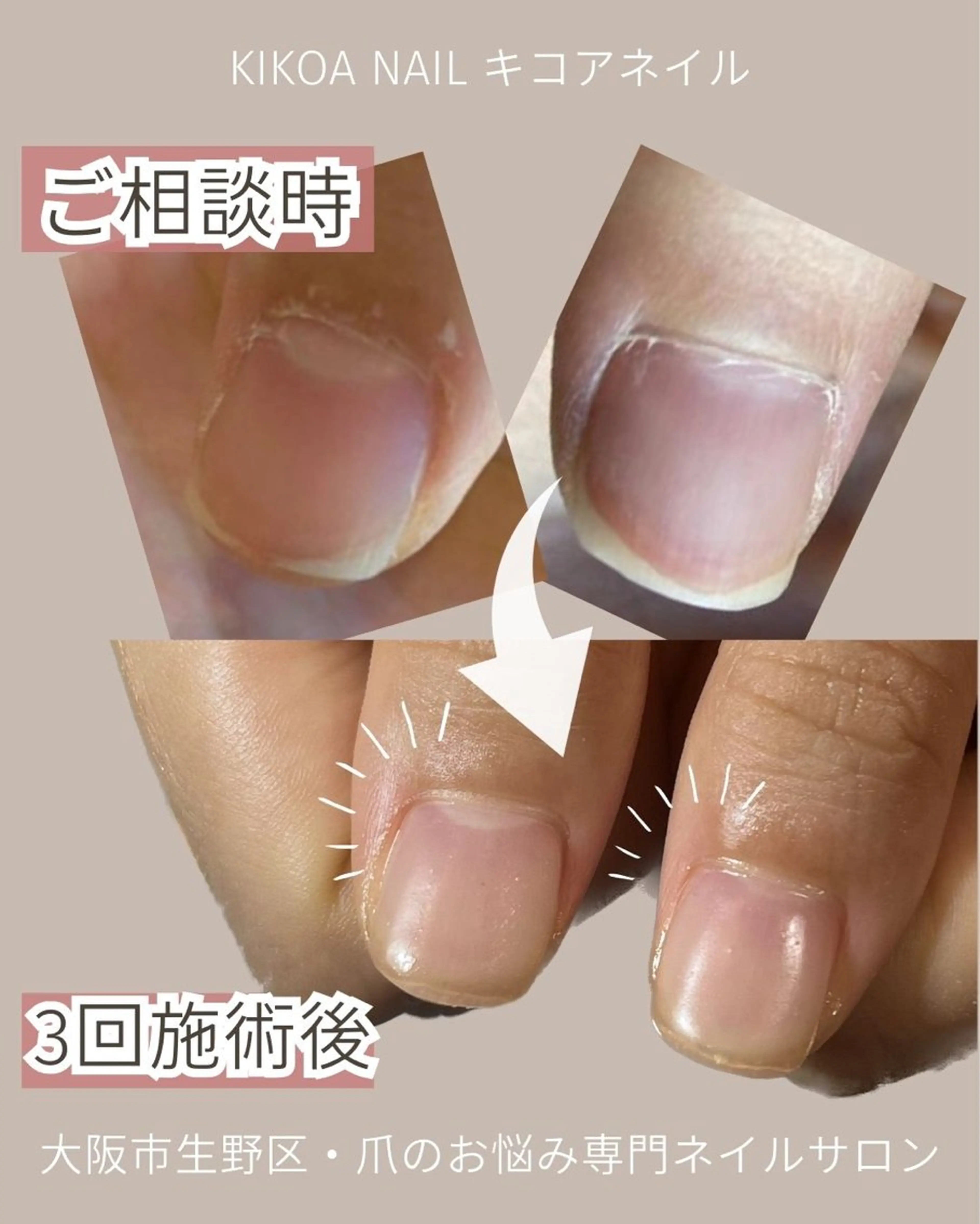 ネイル KIKOA NAIL キコアネイルのネイルデザイン