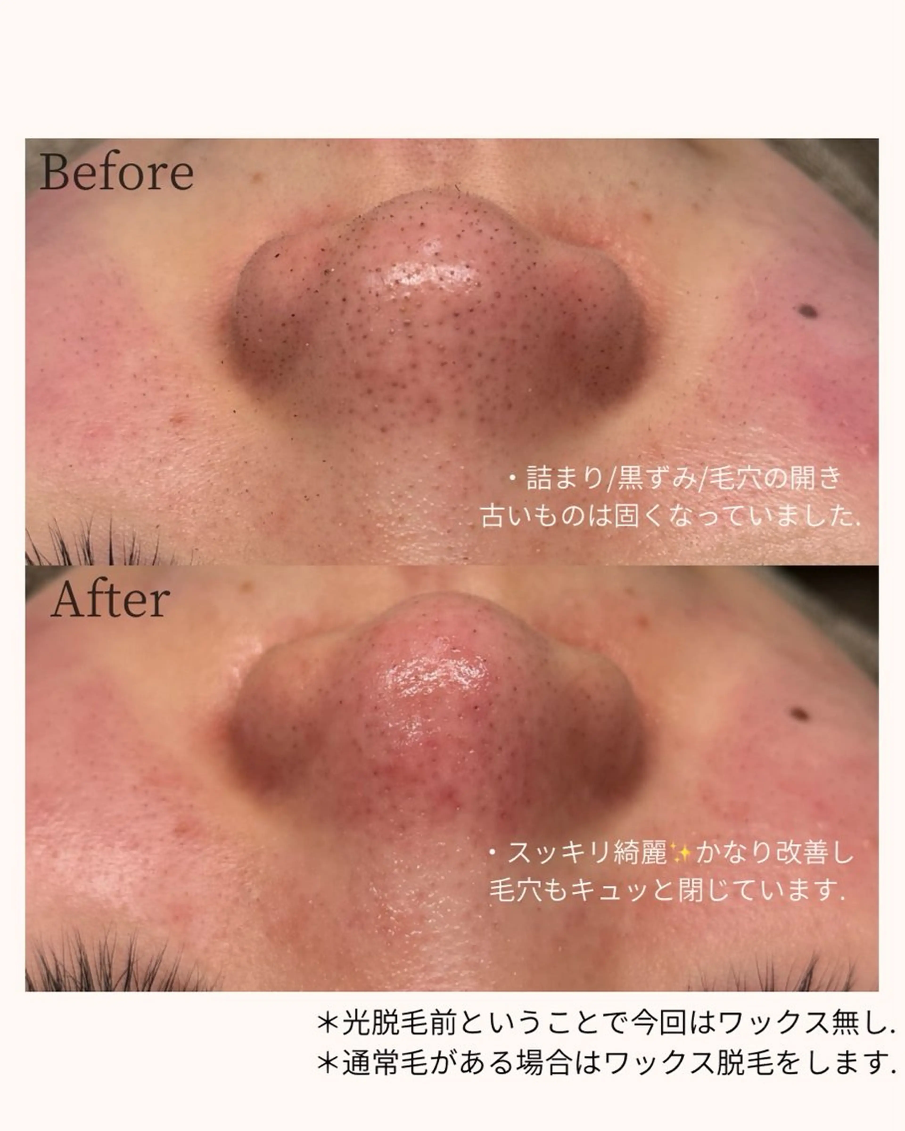 エステ 毛穴と脱毛のお店 "Lea" 壷林のエステ・リラクイメージ