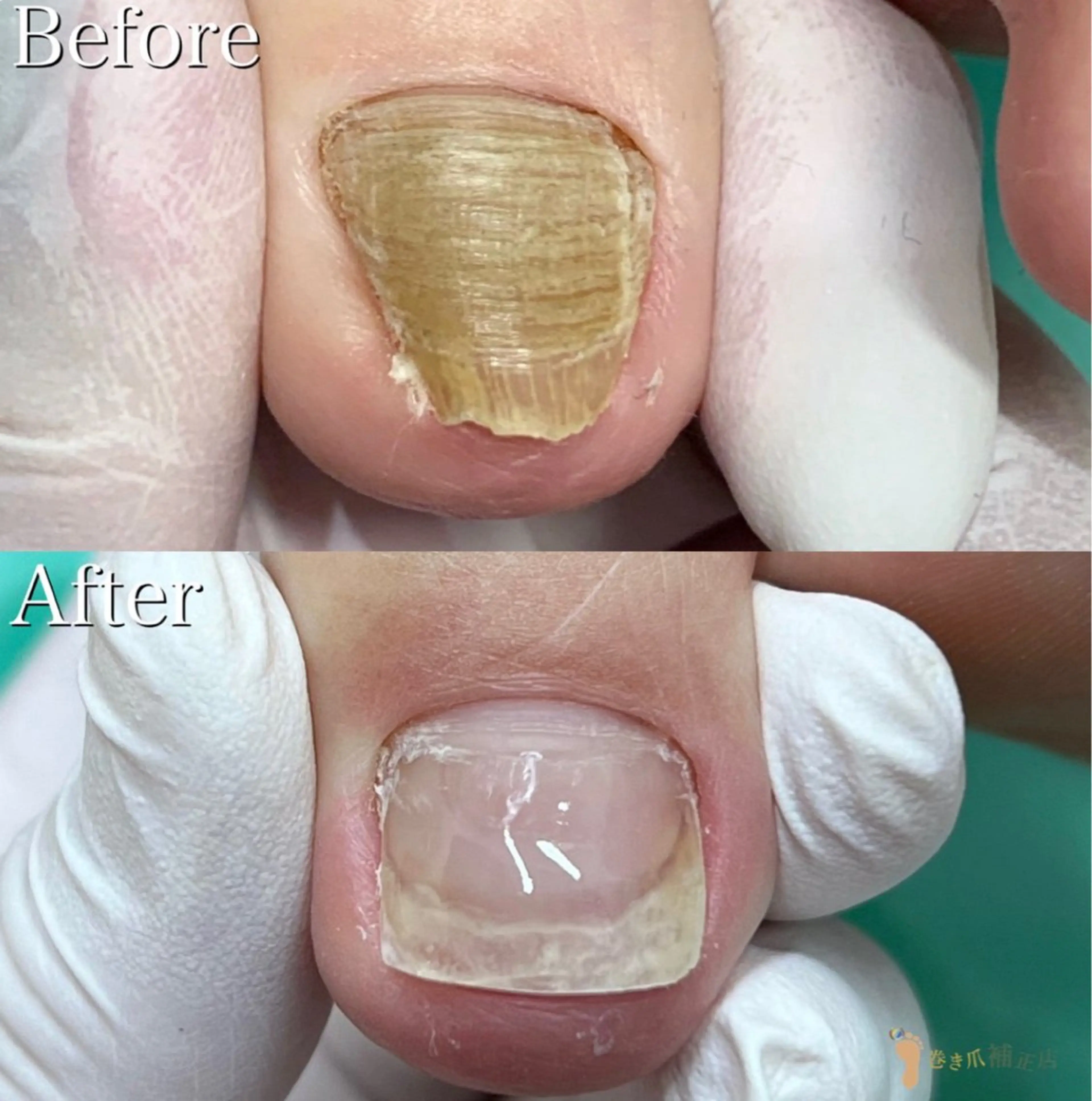 リラク 福岡巻き爪補正店 博多店のエステ・リラクイメージ