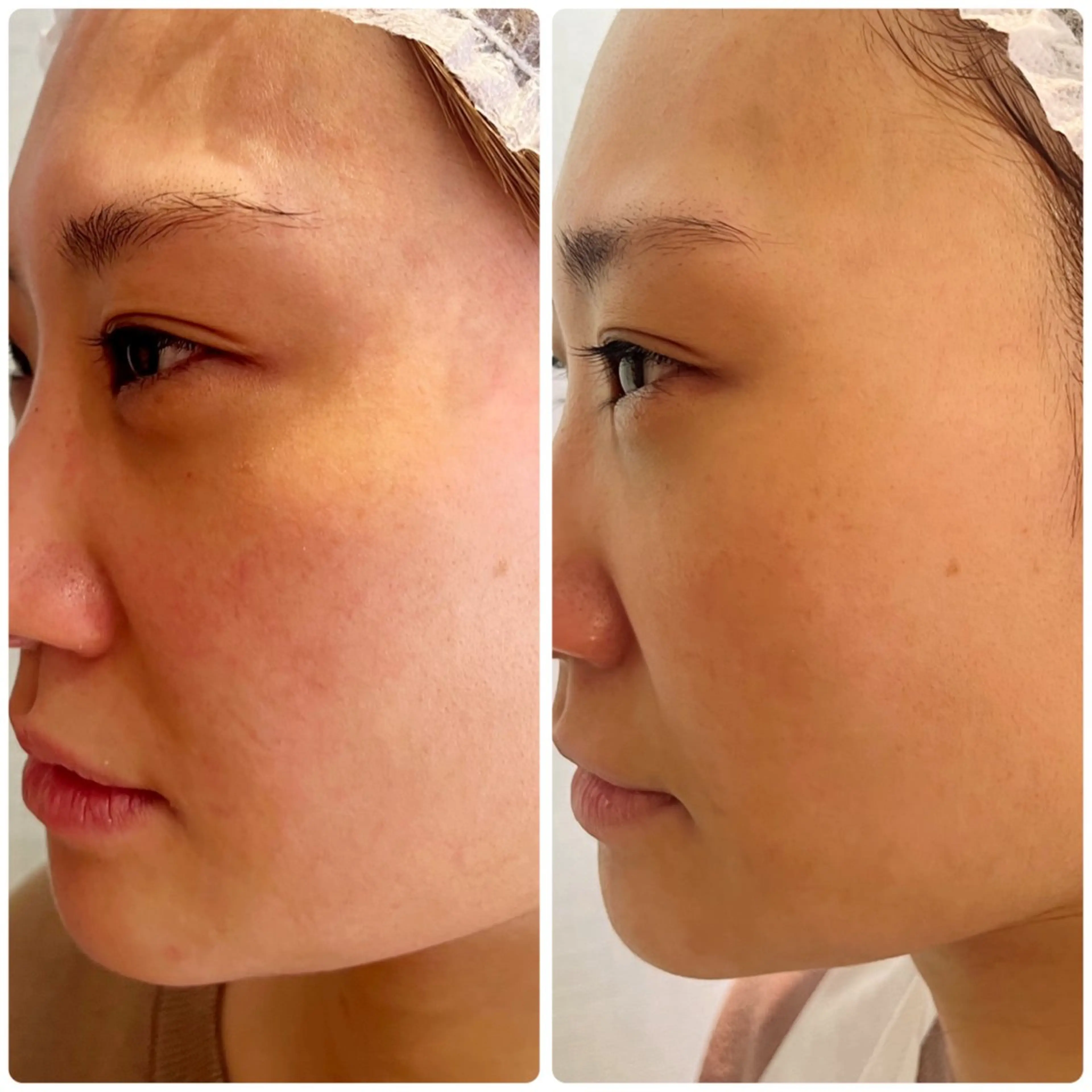 💎うる艶肌💎 スズキのエステ・リラクイメージ