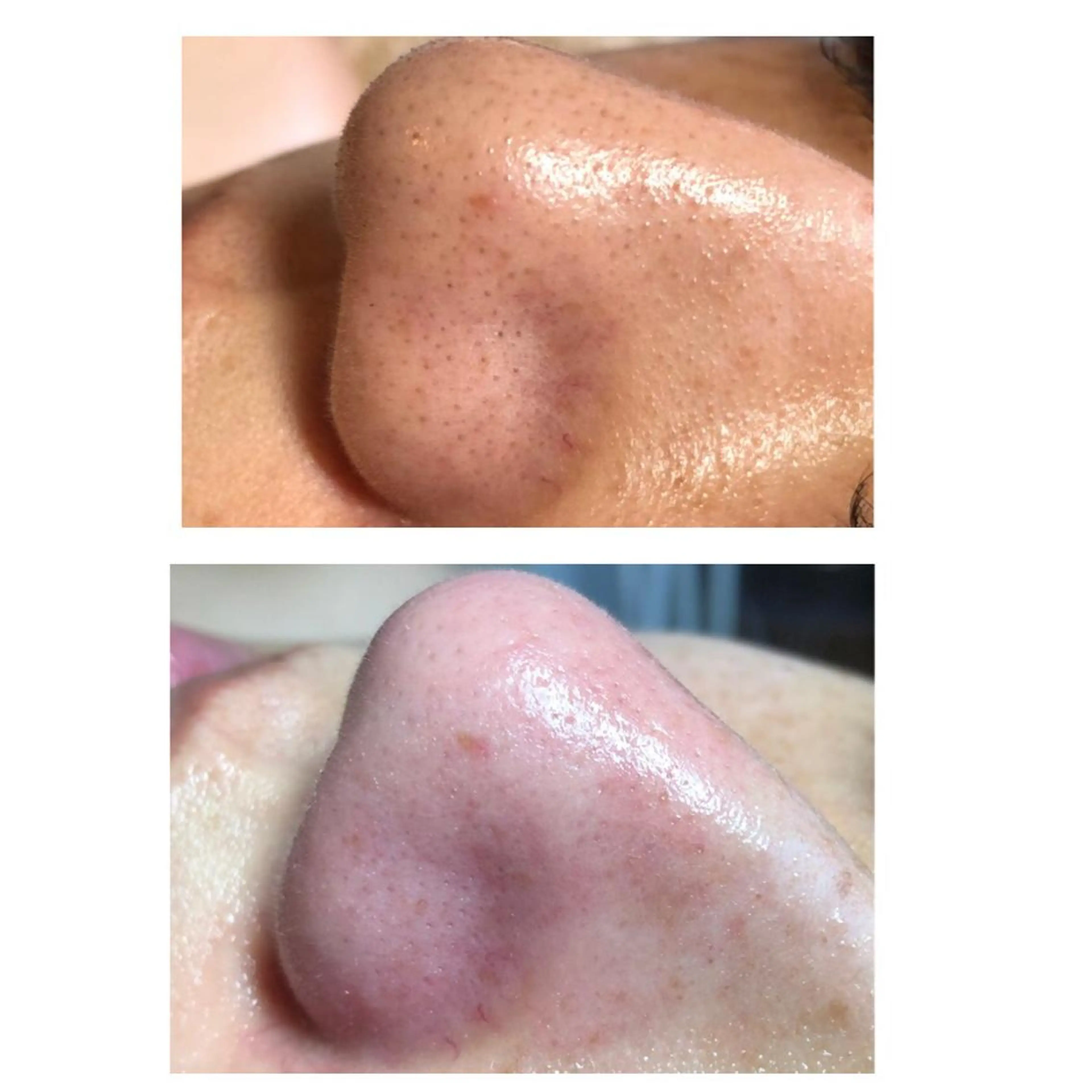 i'llbe イルビーのエステ・リラクイメージ