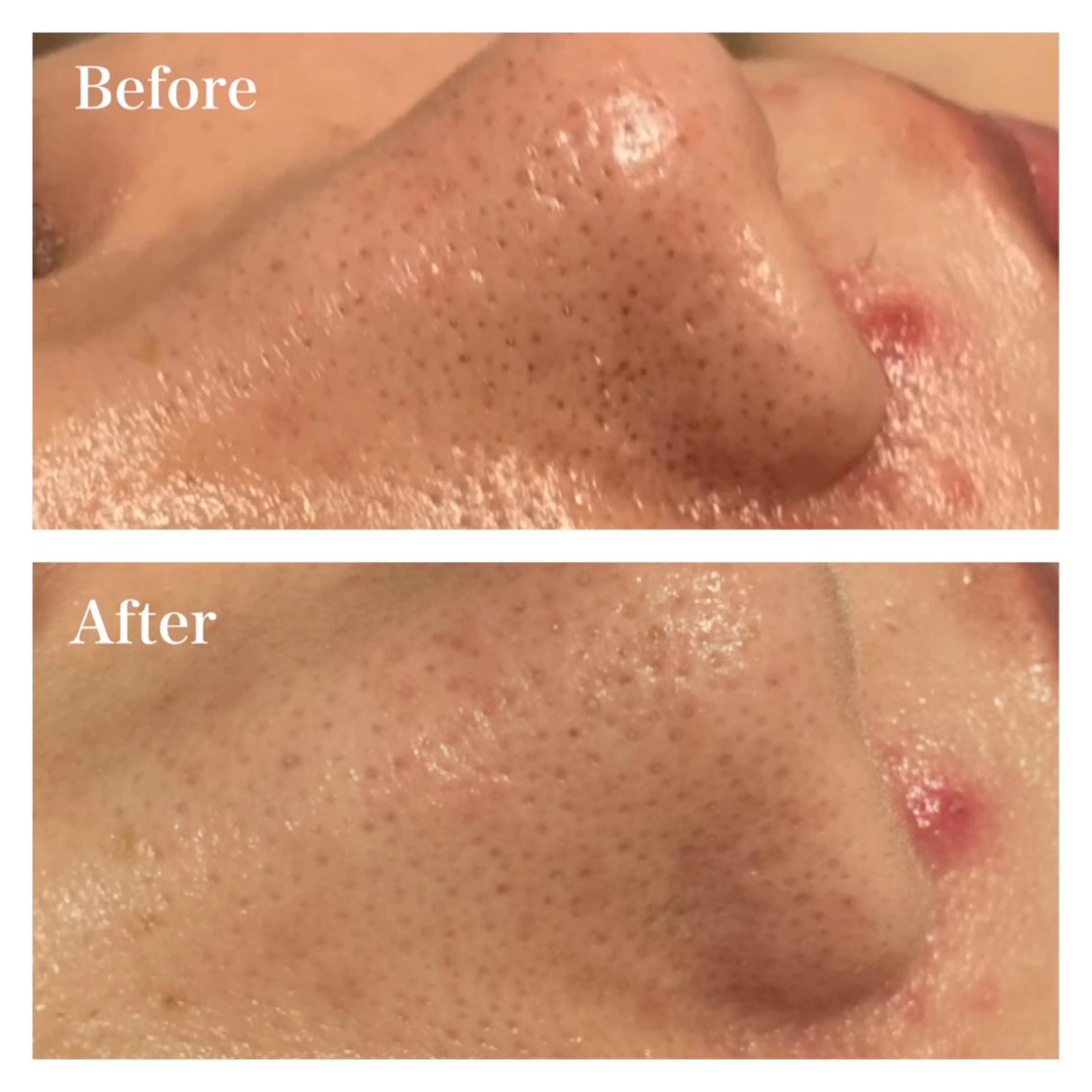 エステ リラク Ｂ&H所属・頭痛肩こり改善/小顔 サロンB&H心斎橋のエステ・リラクイメージ