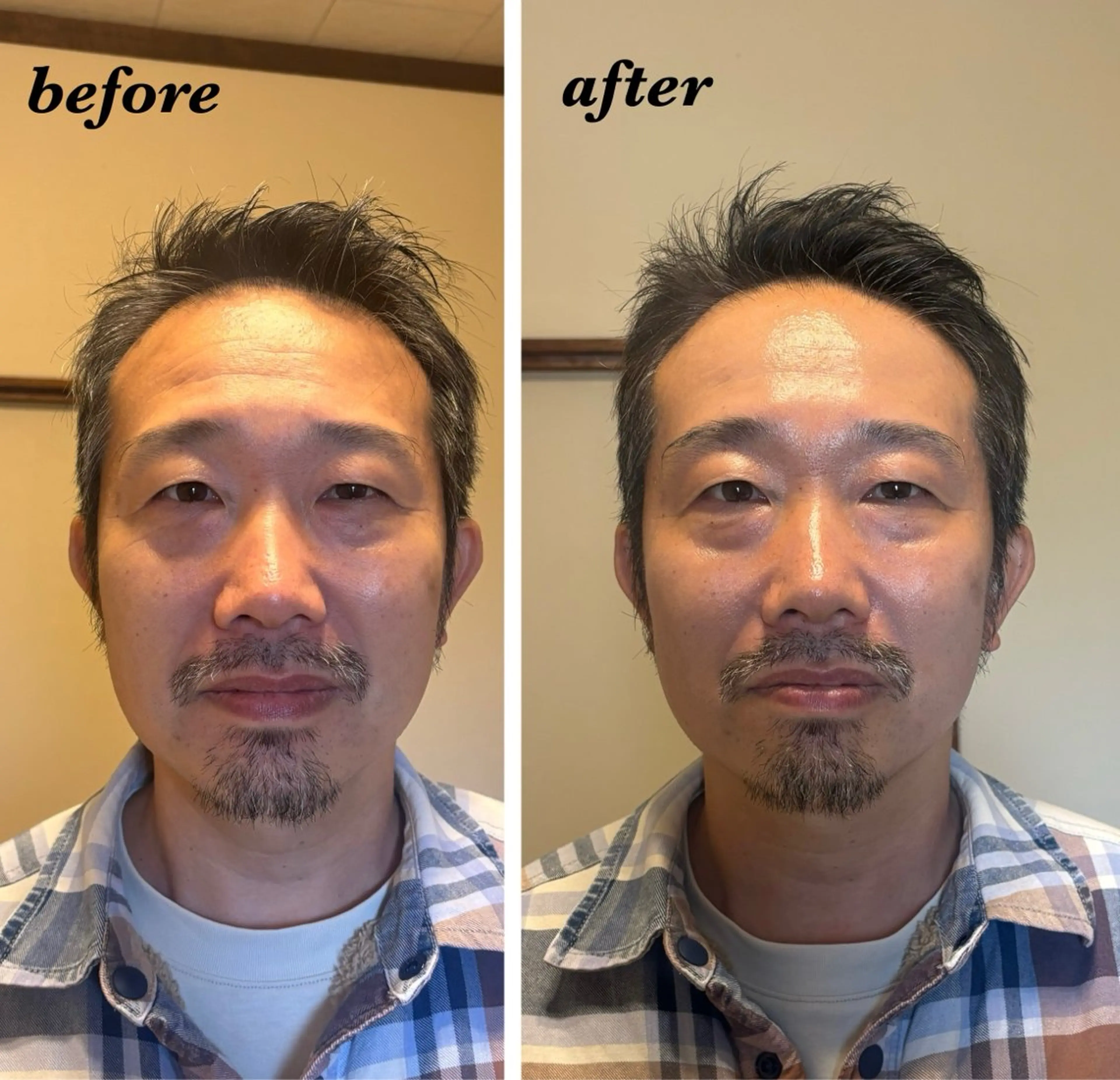 ハーブピーリング専門 毛穴洗浄❤️眉waxのエステ・リラクイメージ