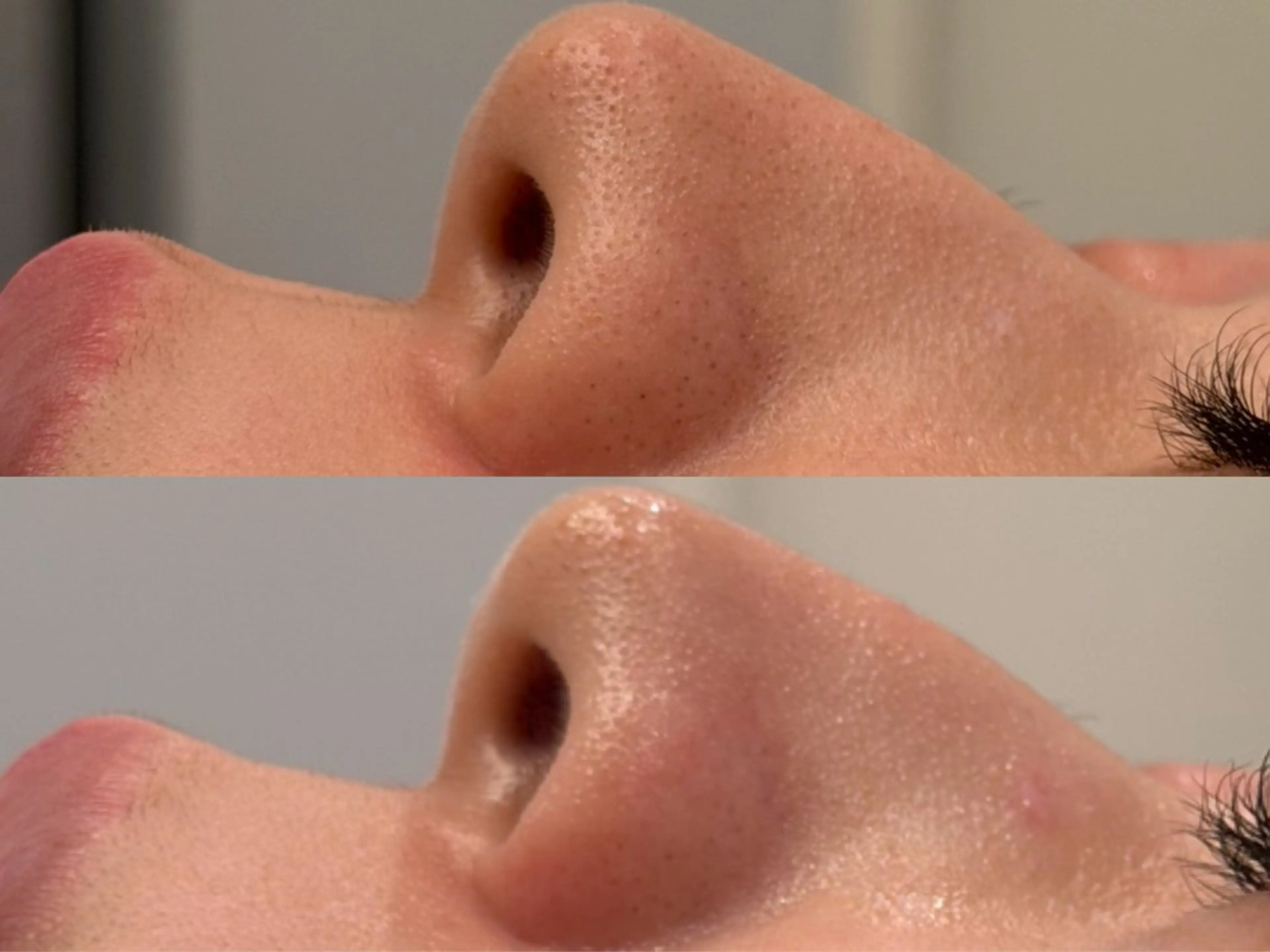 その他 べアール所属・小顔/毛穴/ニキビ salon bealのエステ・リラクイメージ