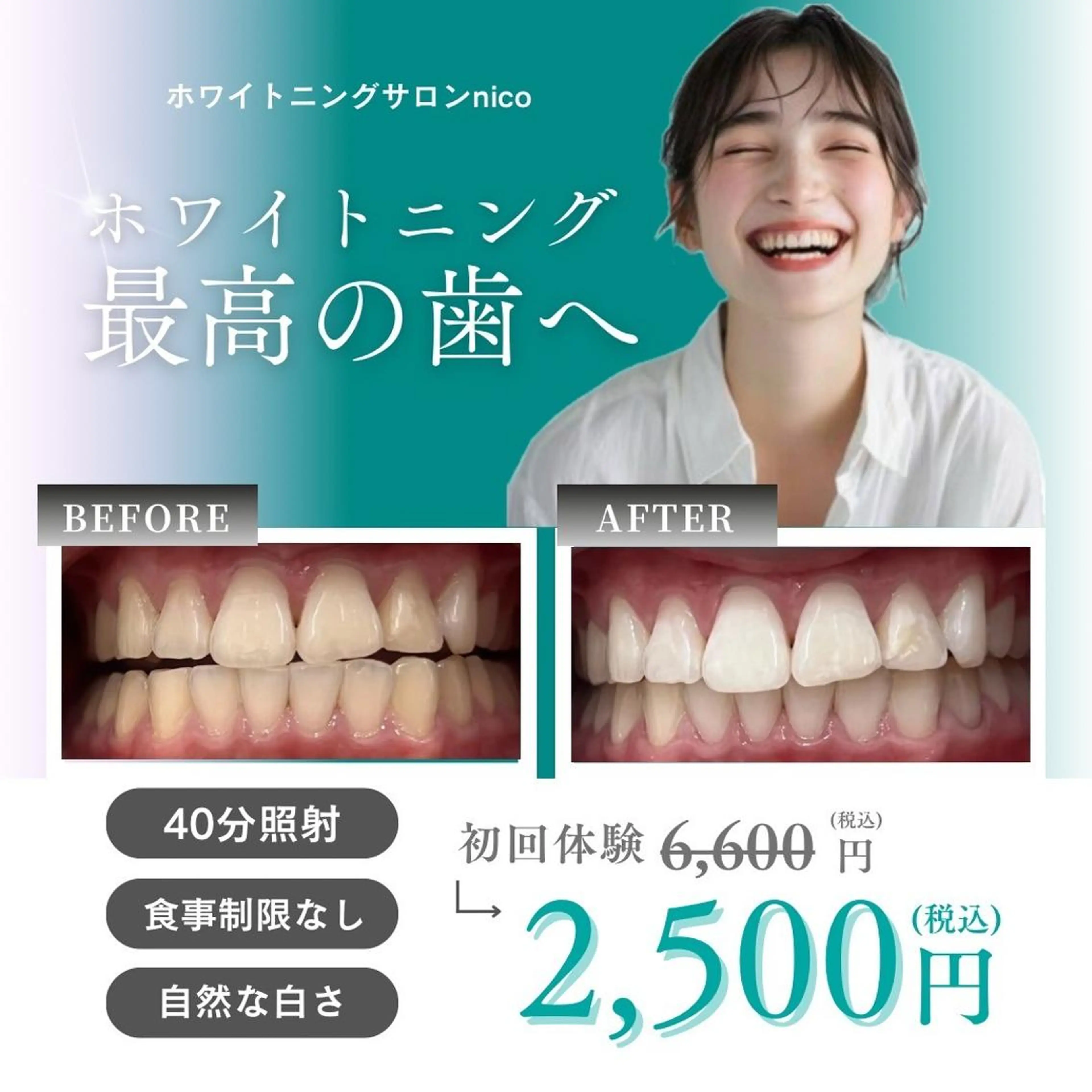 ミディアム カラー 学生 その他 ホワイトニングサロン nico西葛西店のその他イメージ