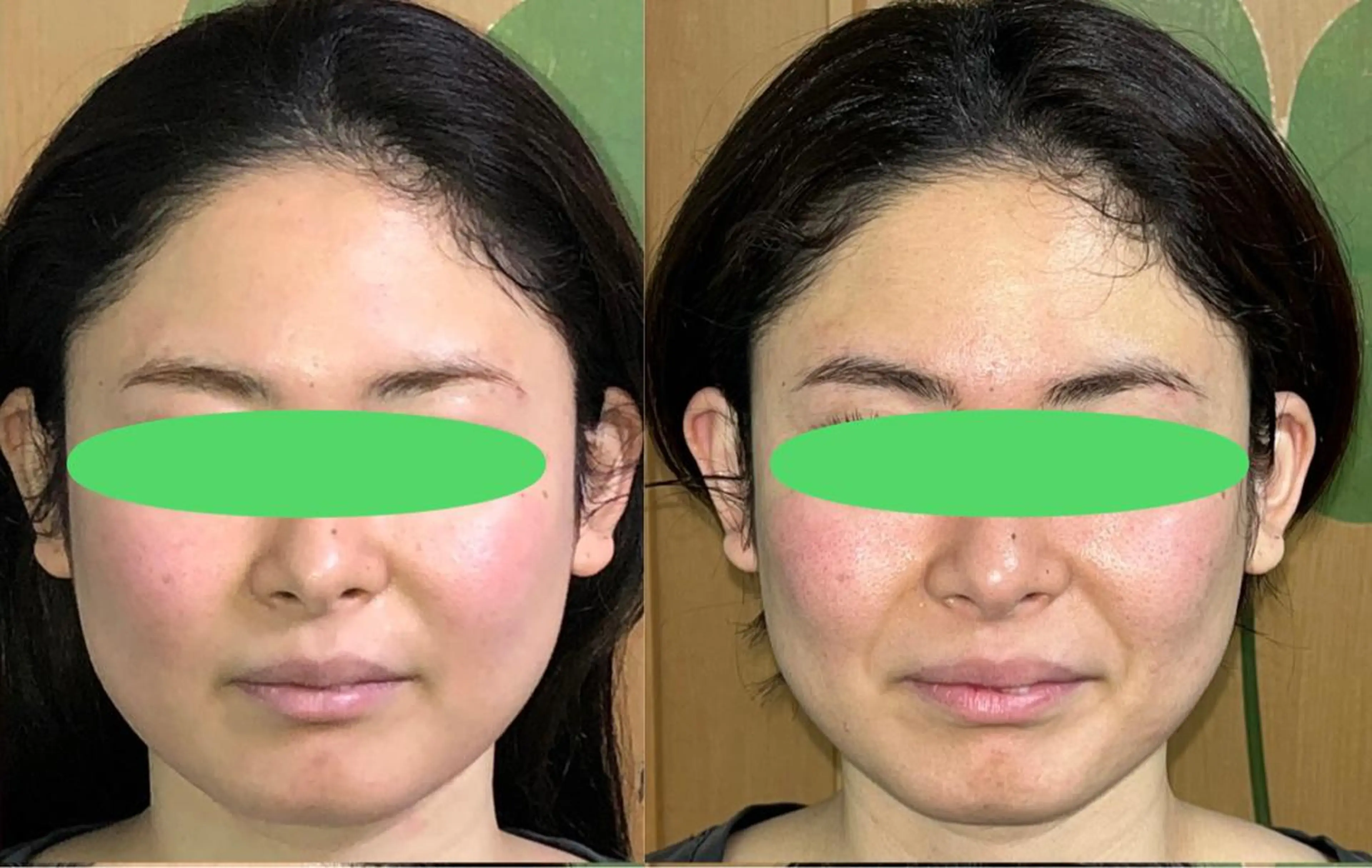 エステ リラク 春日井トータルからだ サロンふくふくのエステ・リラクイメージ