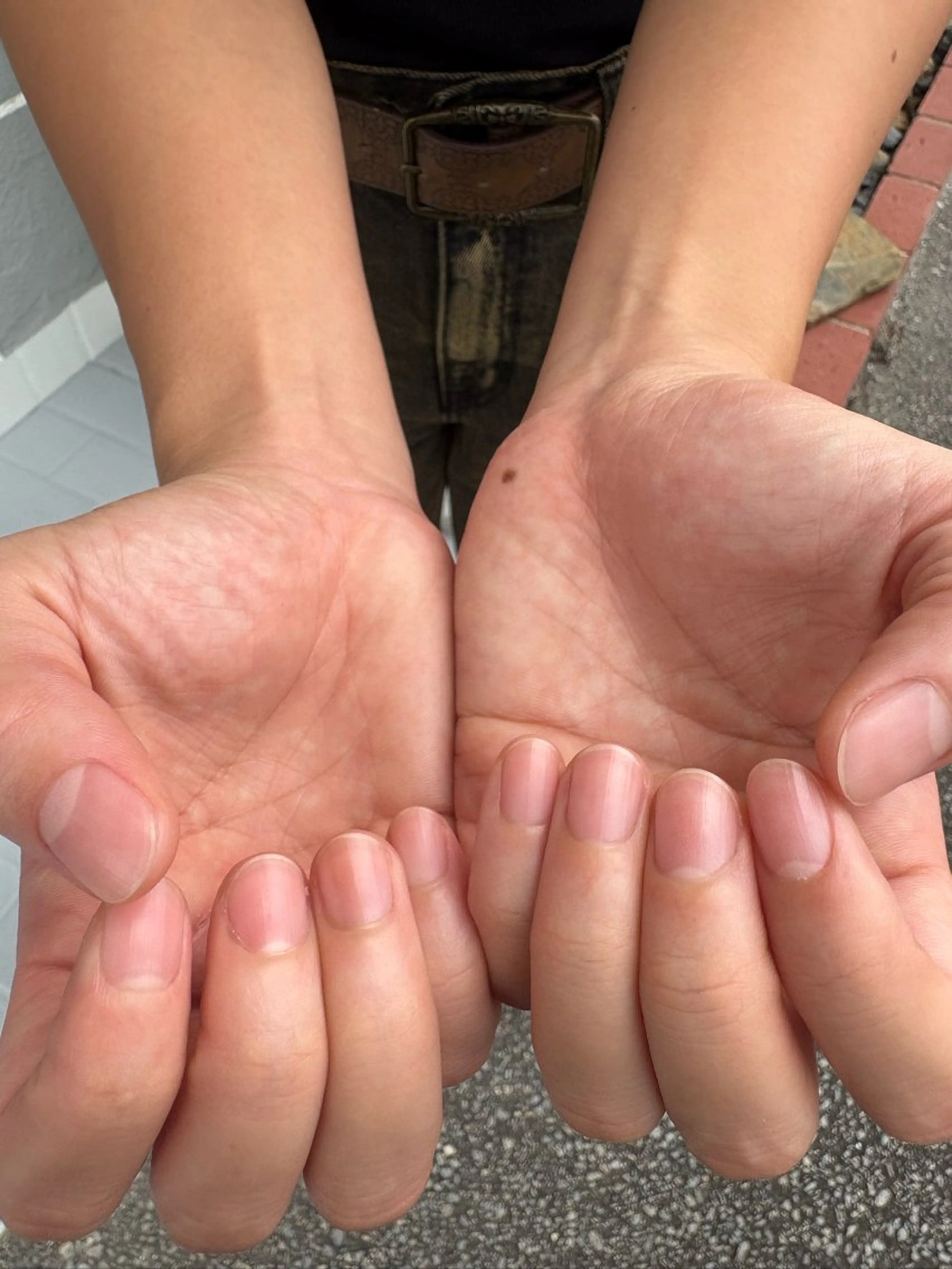 簡易ケア(男性の方も◎)の写真