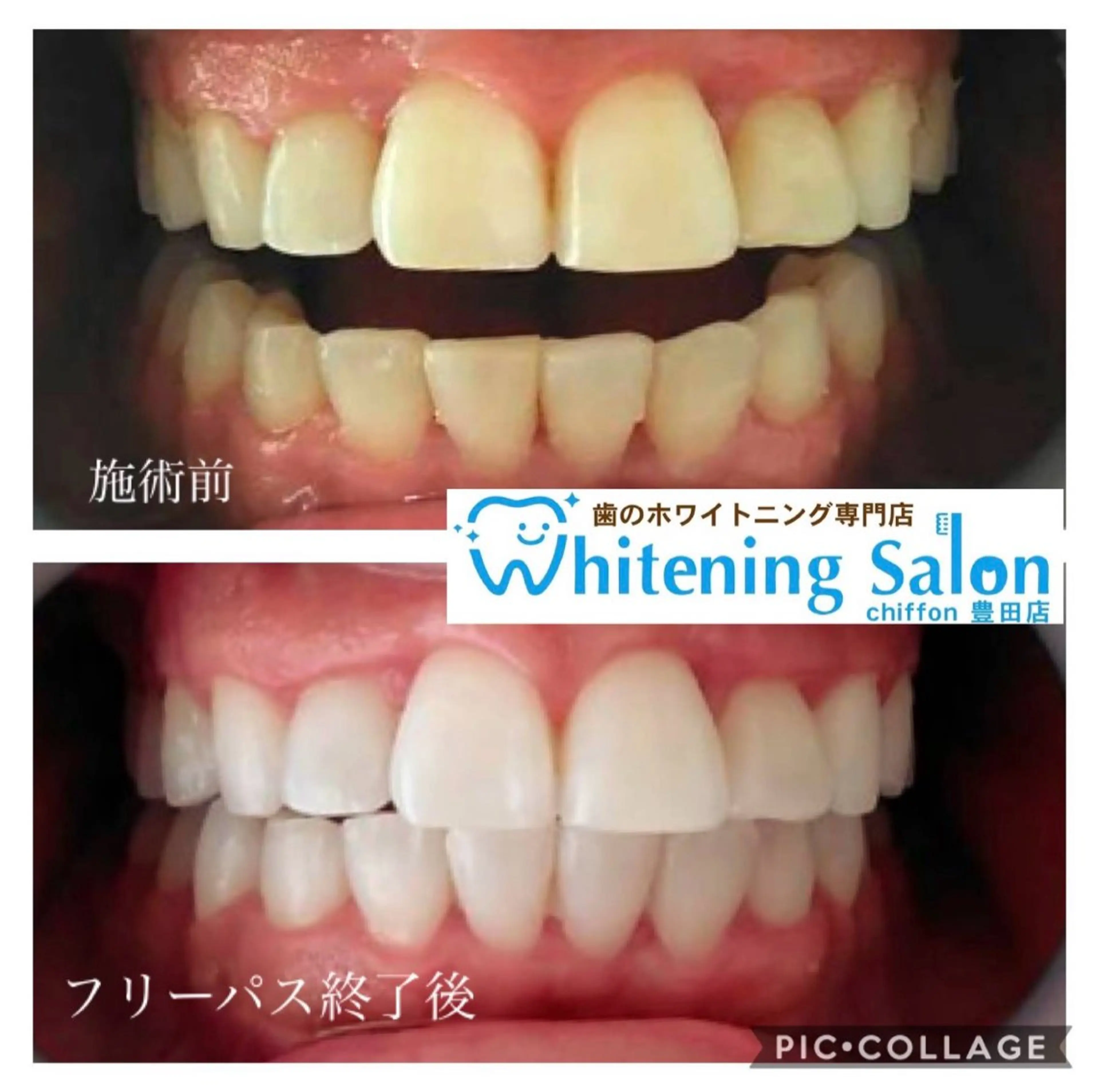 ホワイトニングサロン シフォン豊田店のエステ・リラクイメージ