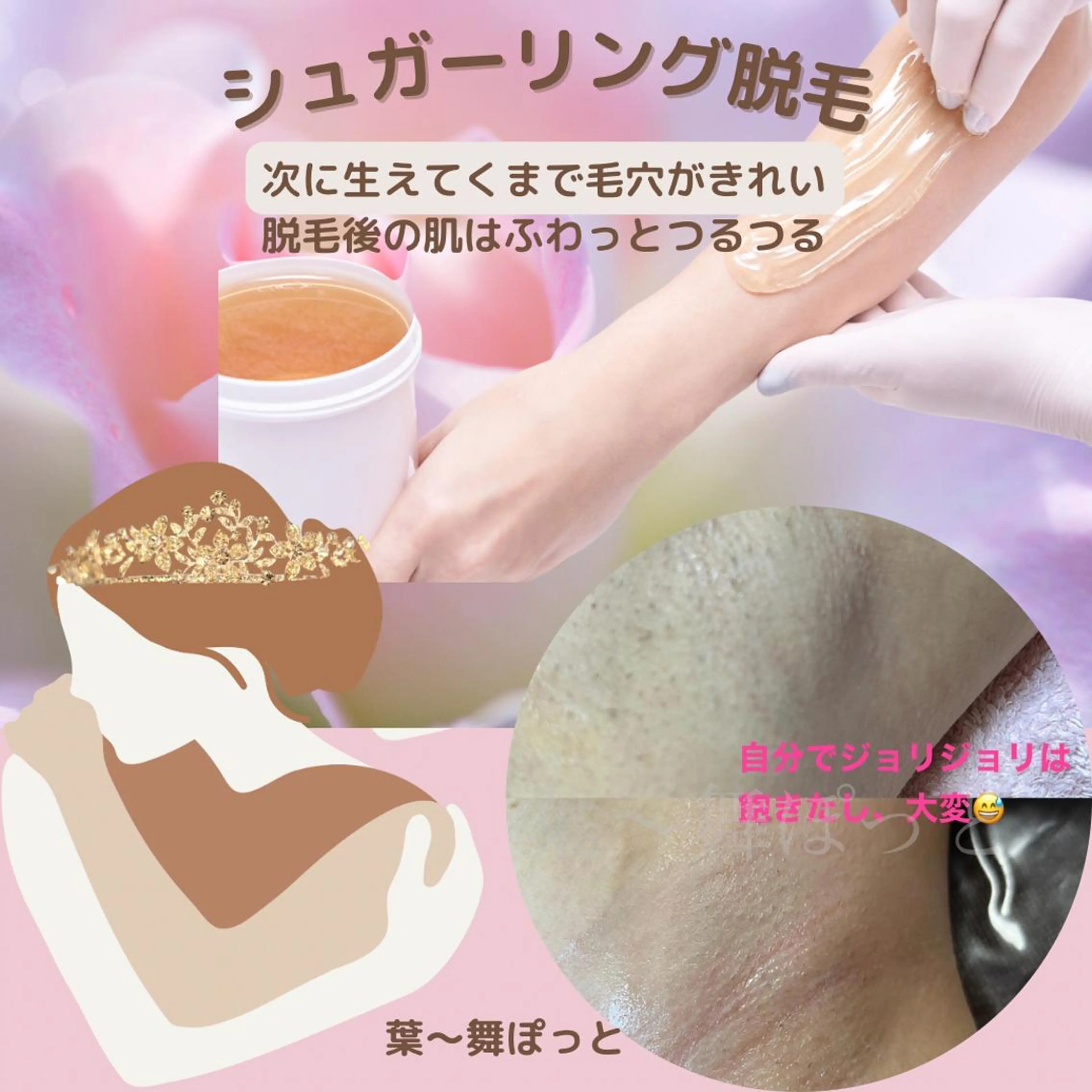 シュガーリング脱毛　腕ハーフ（手首​〜​肩下）の写真