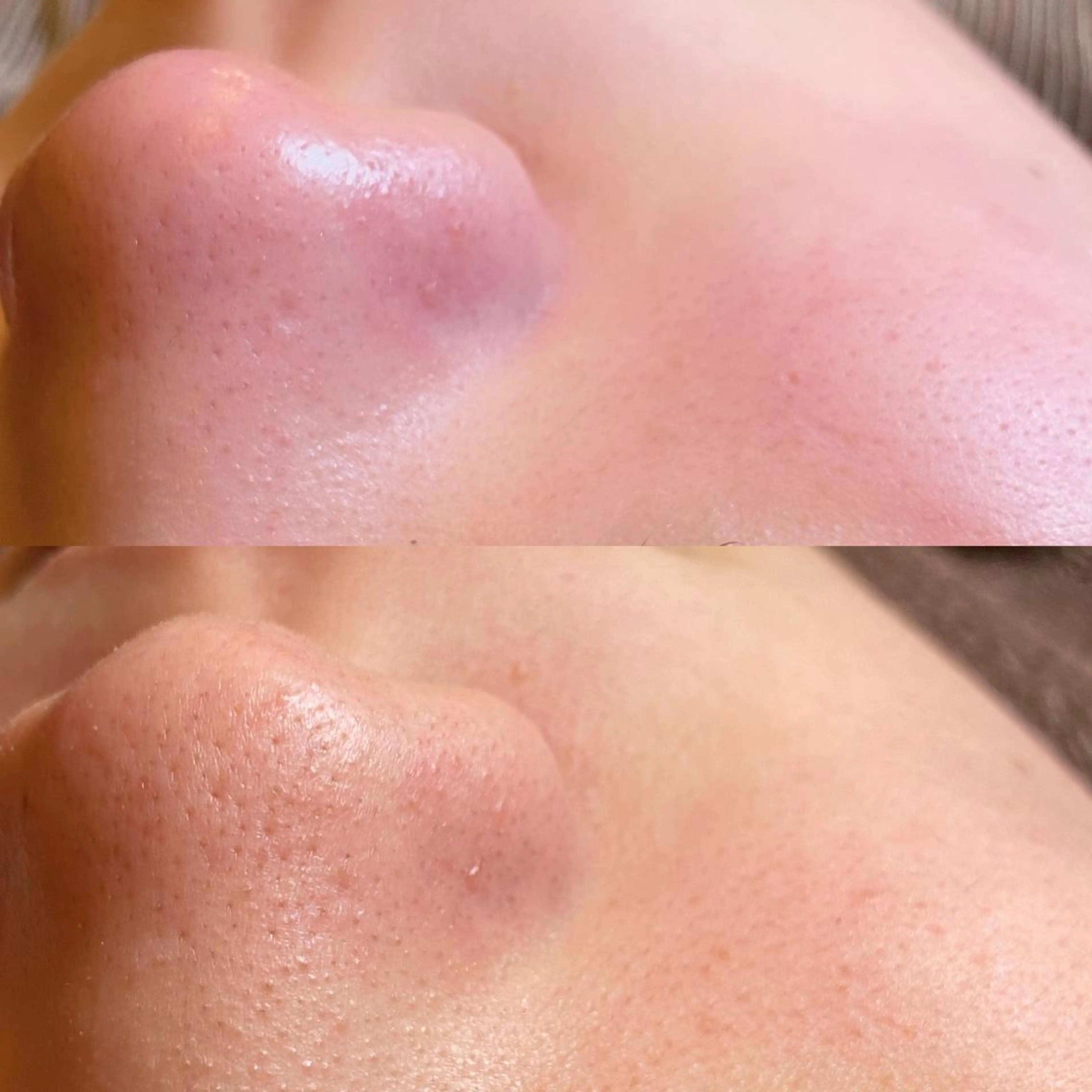 エステ トータルビューティー マウロアのエステ・リラクイメージ