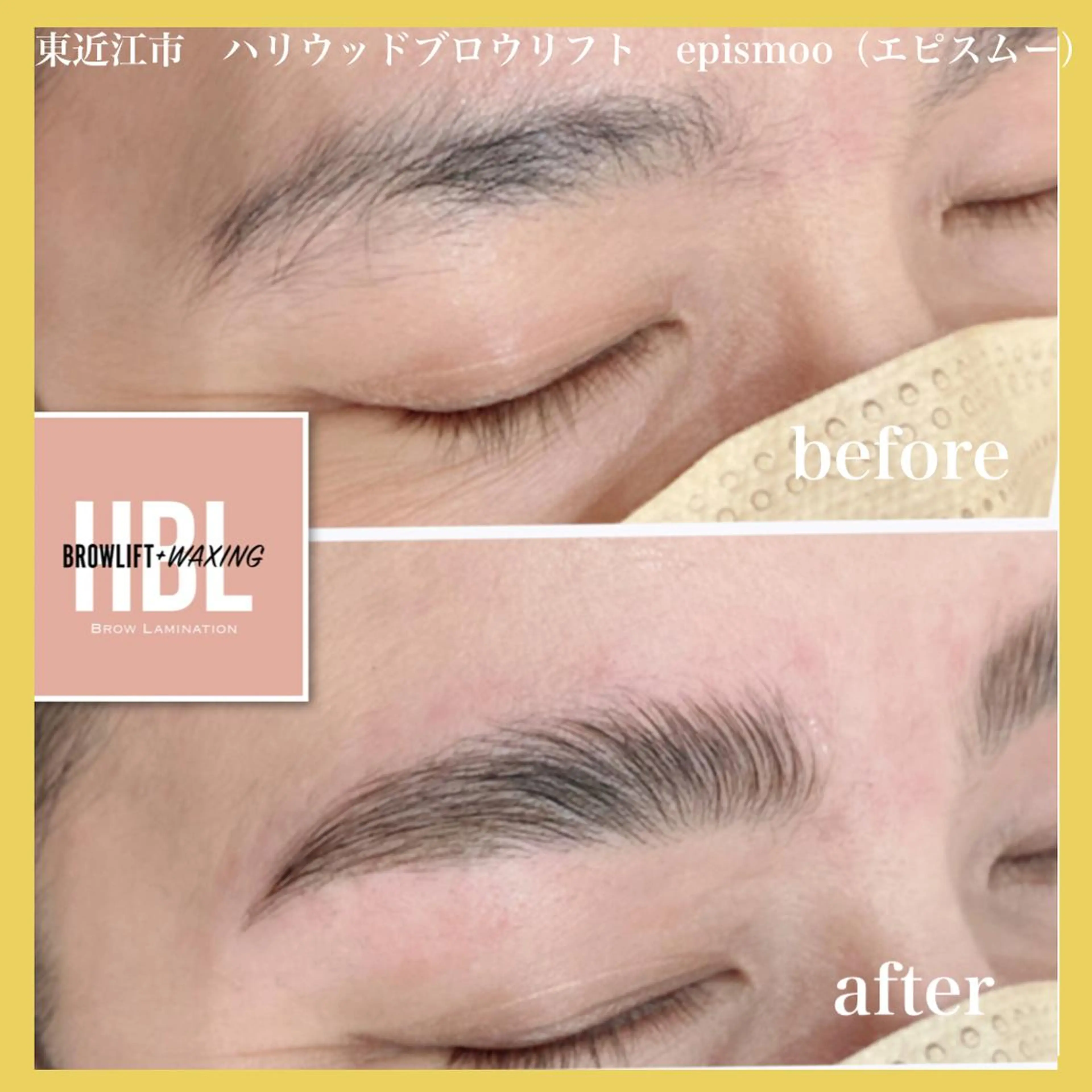 アイブロウ epismoo 脱毛/HBL/毛穴の眉毛・アイブロウイメージ
