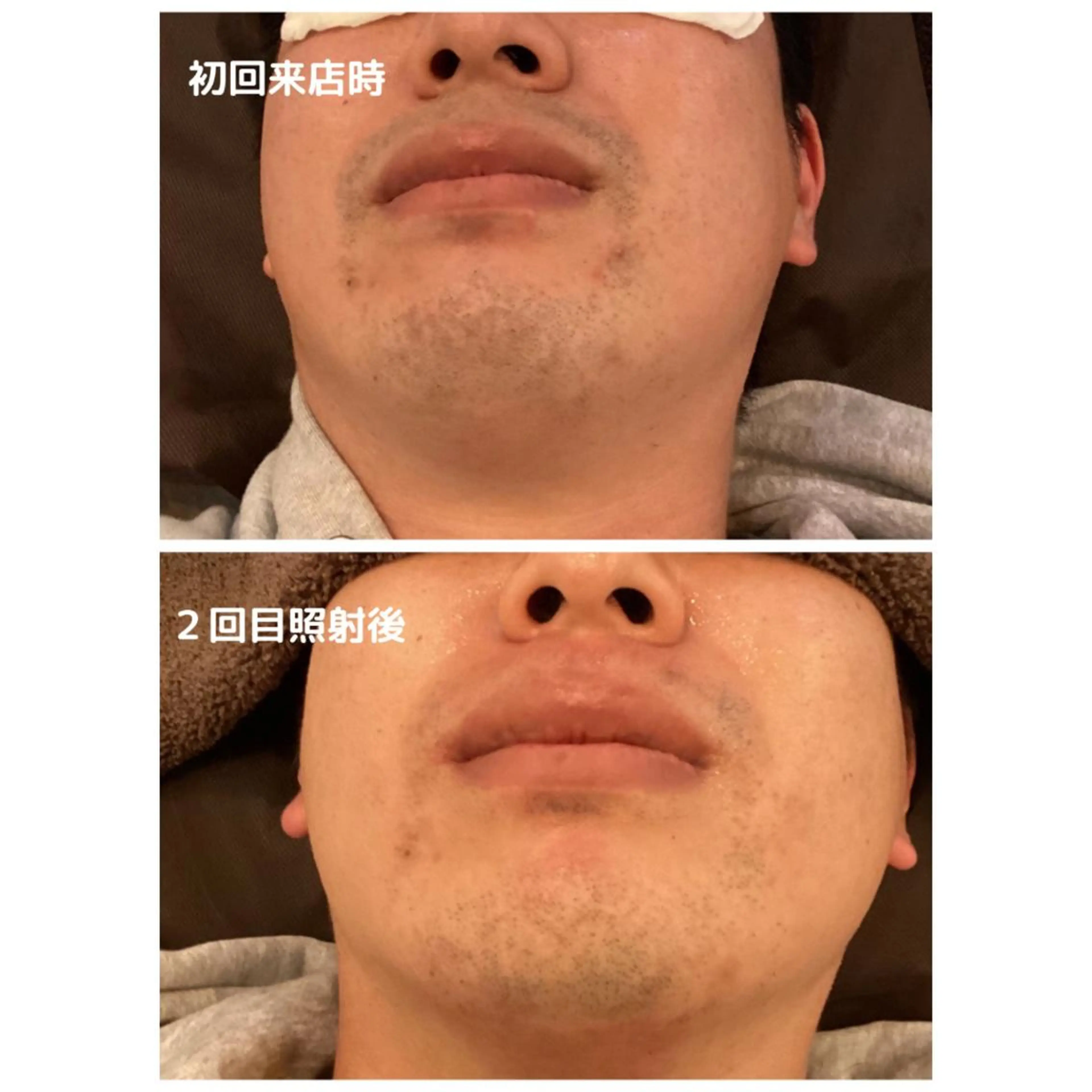 メンズ men's脱毛サロン ECXIAのエステ・リラクイメージ