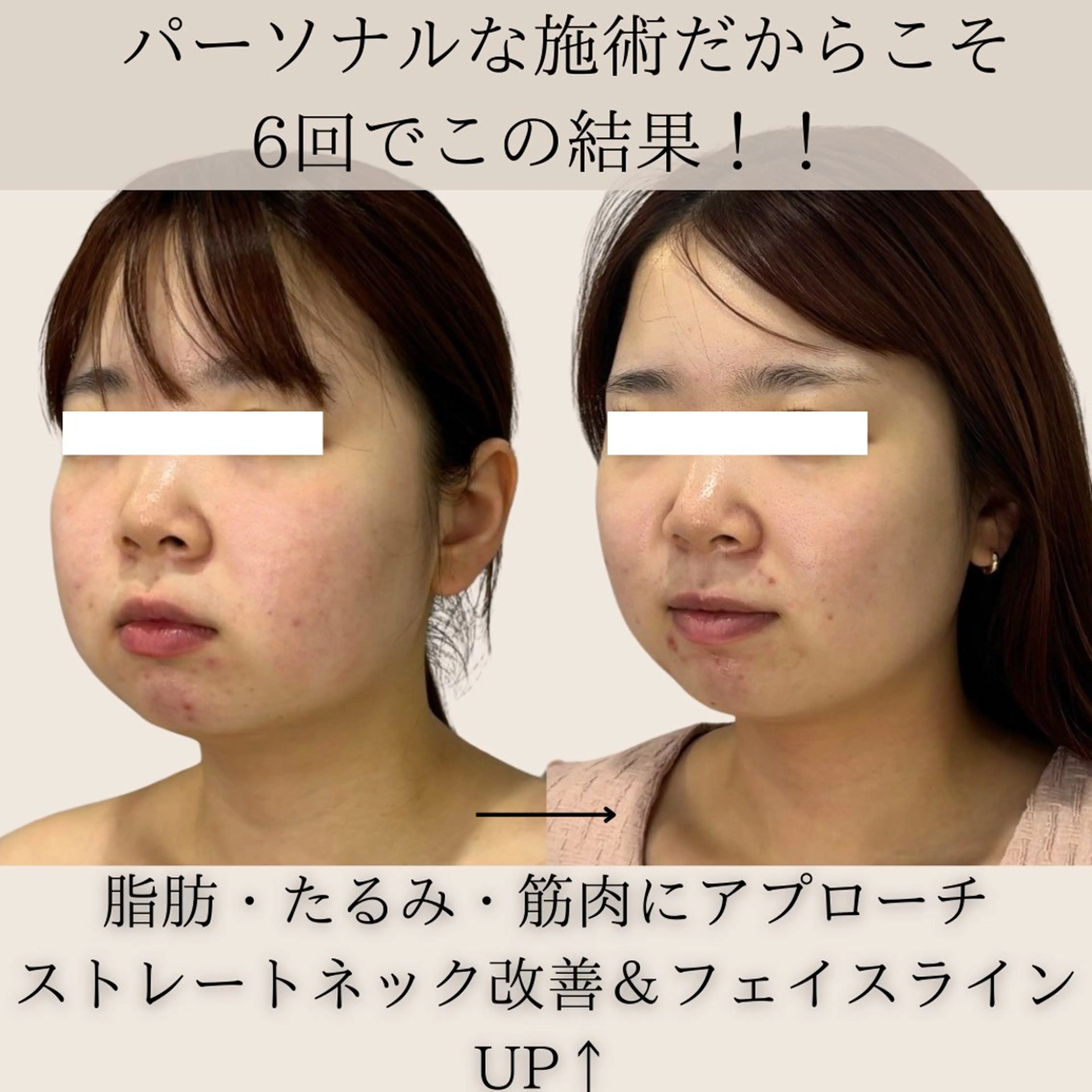 第一印象専門サロン ADISEのエステ・リラクイメージ