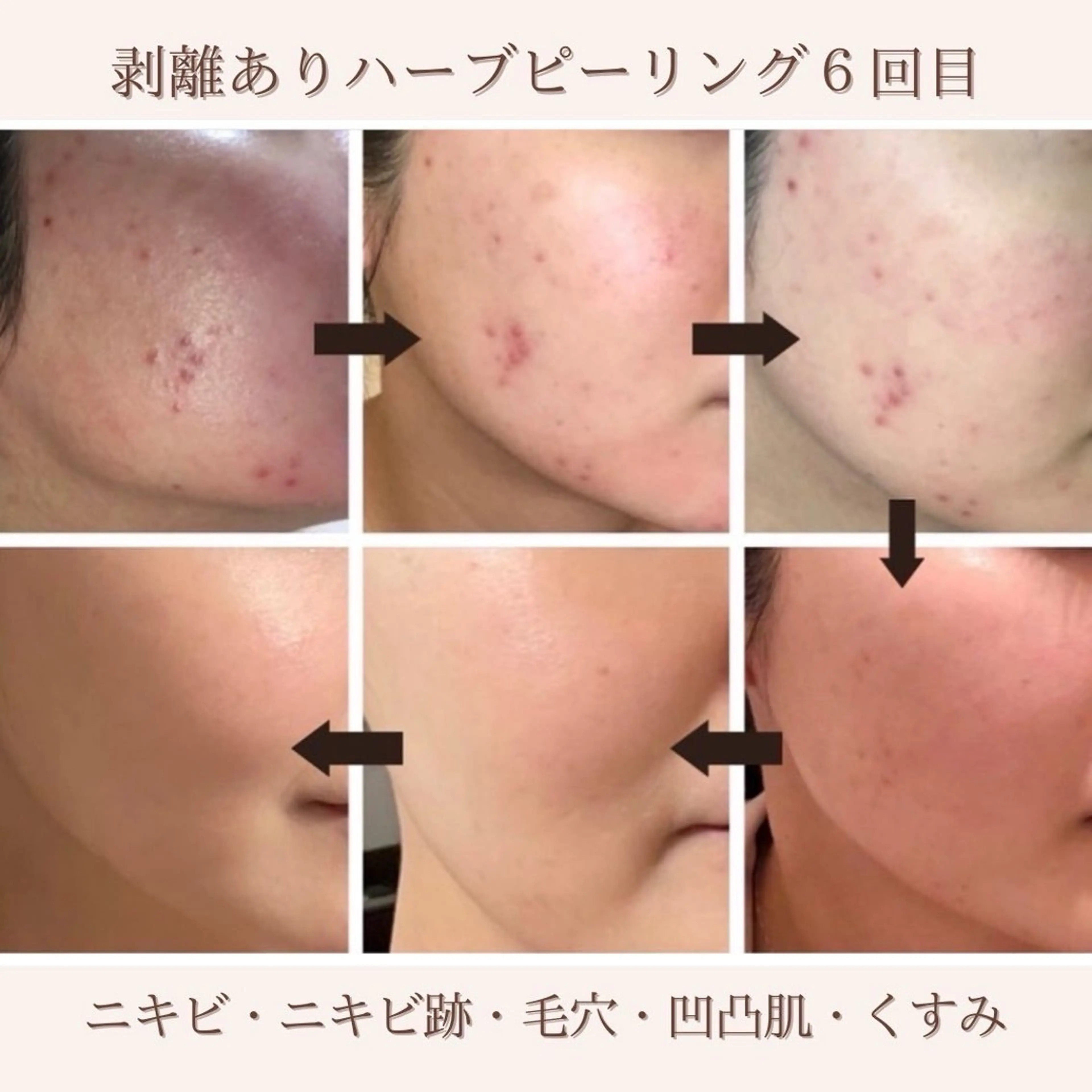 その他 肌質改善サロン ココマヒナのエステ・リラクイメージ