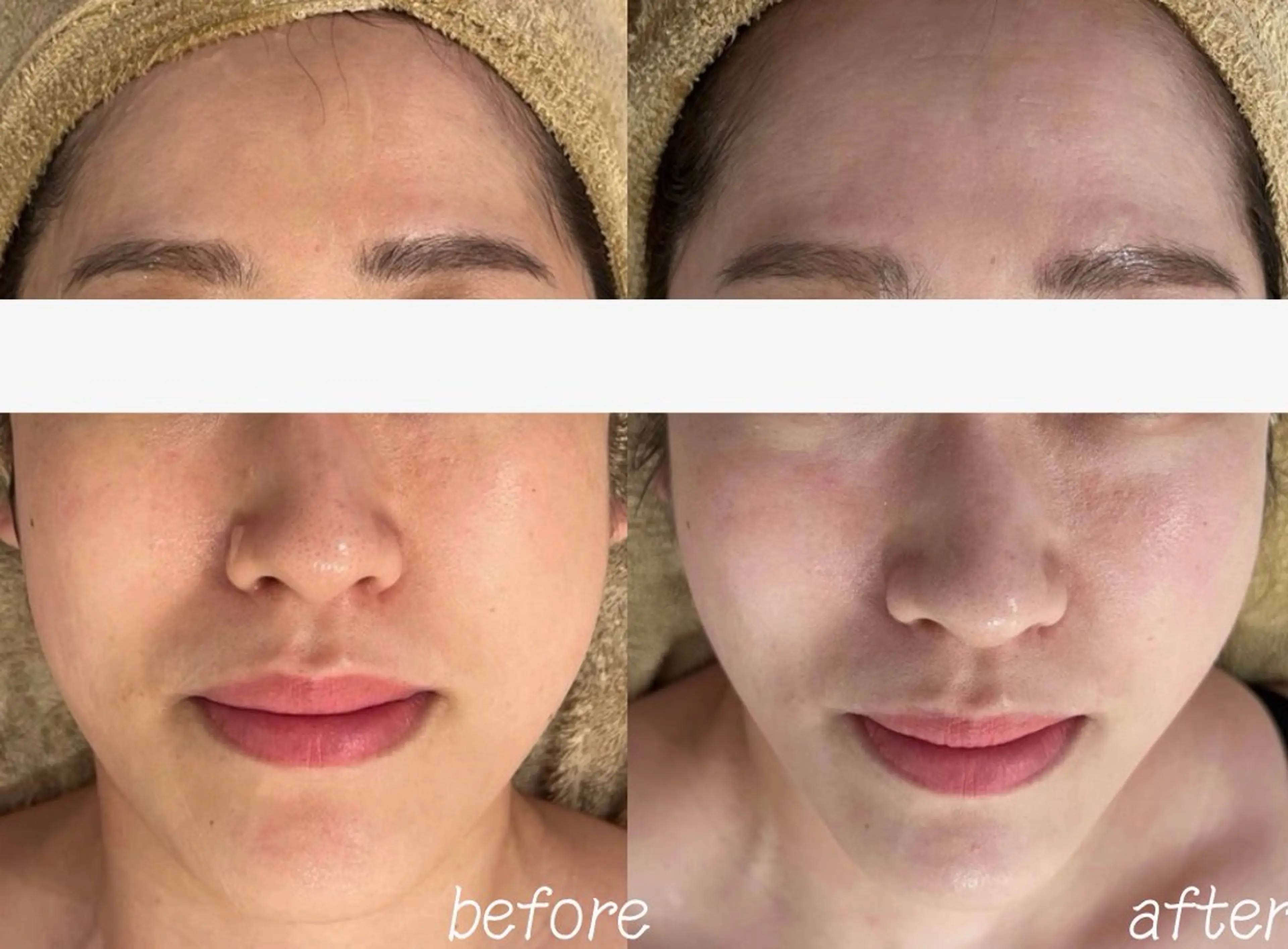 エステ clinical salon enのエステ・リラクイメージ