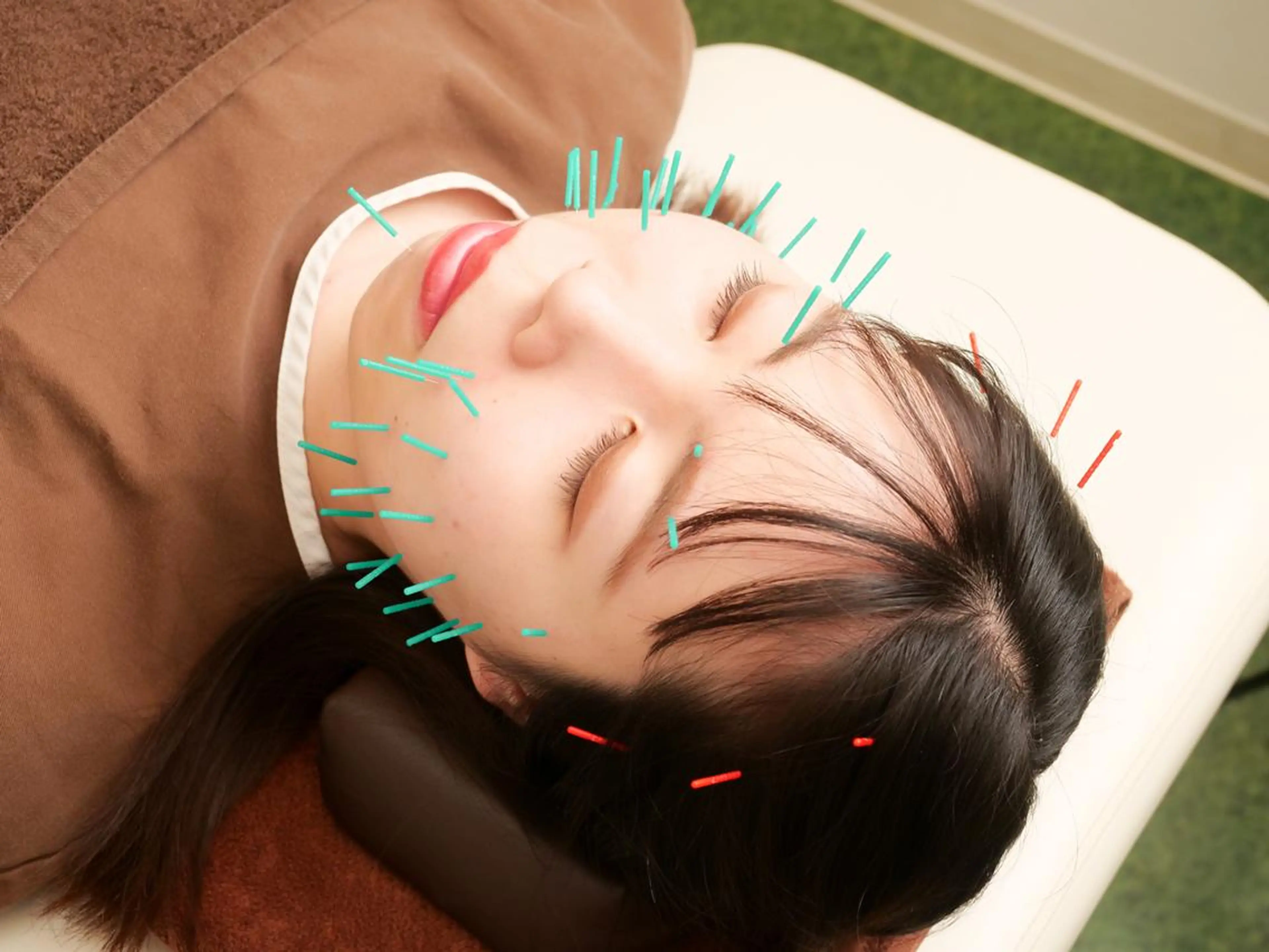 エステ リラク 美容鍼・整体サロン アネモネ🌸心斎橋のエステ・リラクイメージ