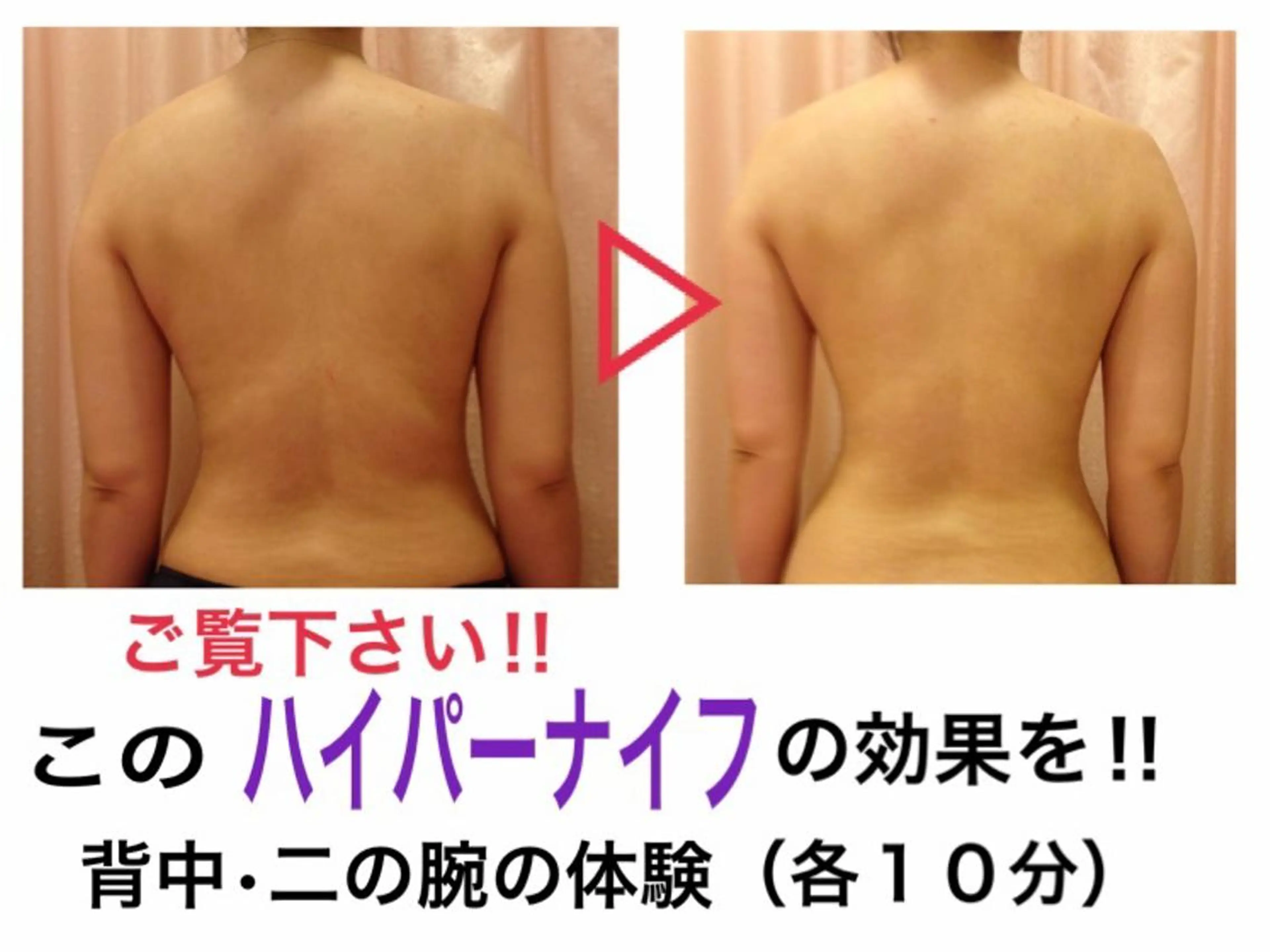 ワックス脱毛 ♡AYO♡のエステ・リラクイメージ