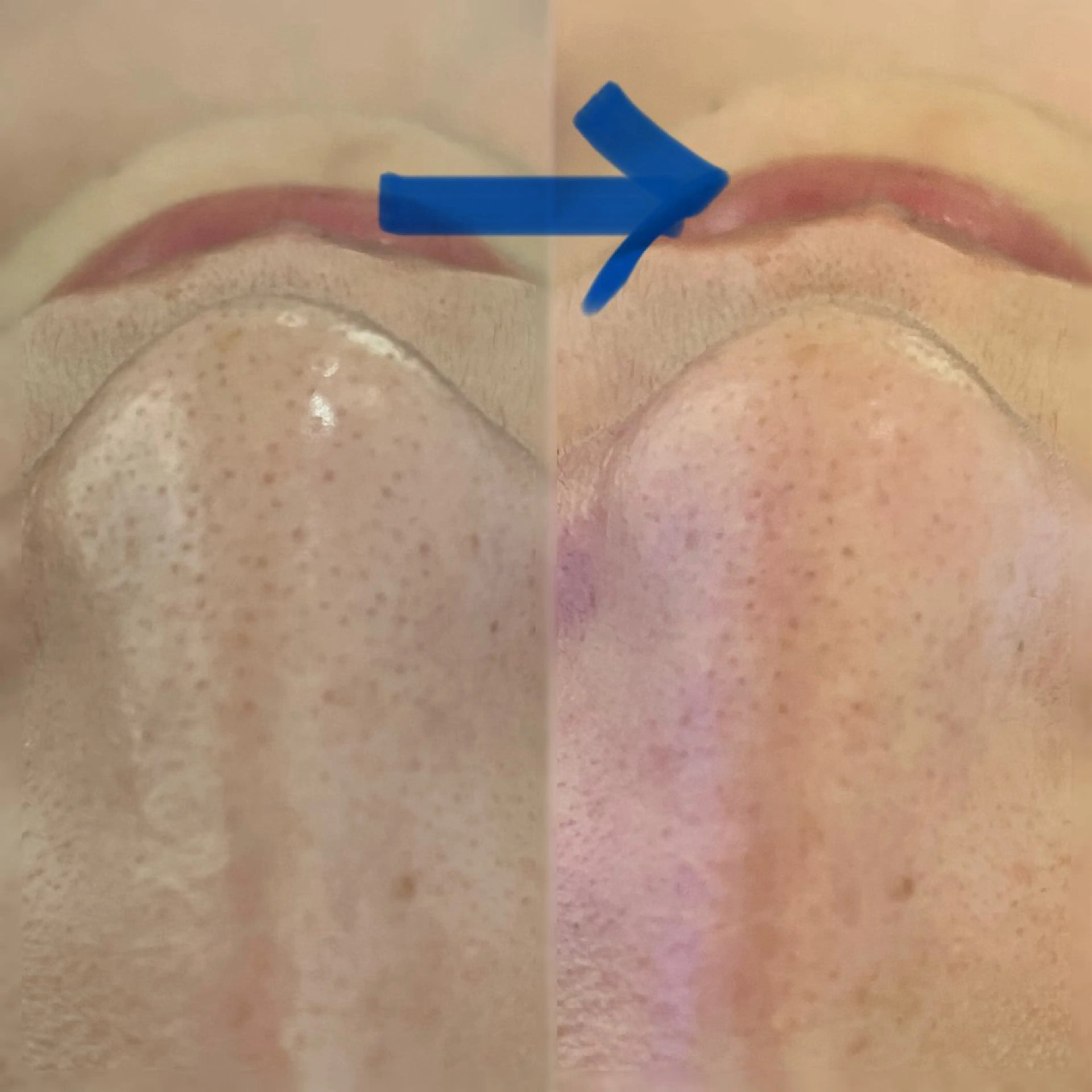 Blue Moon 【ブルームーン】のエステ・リラクイメージ