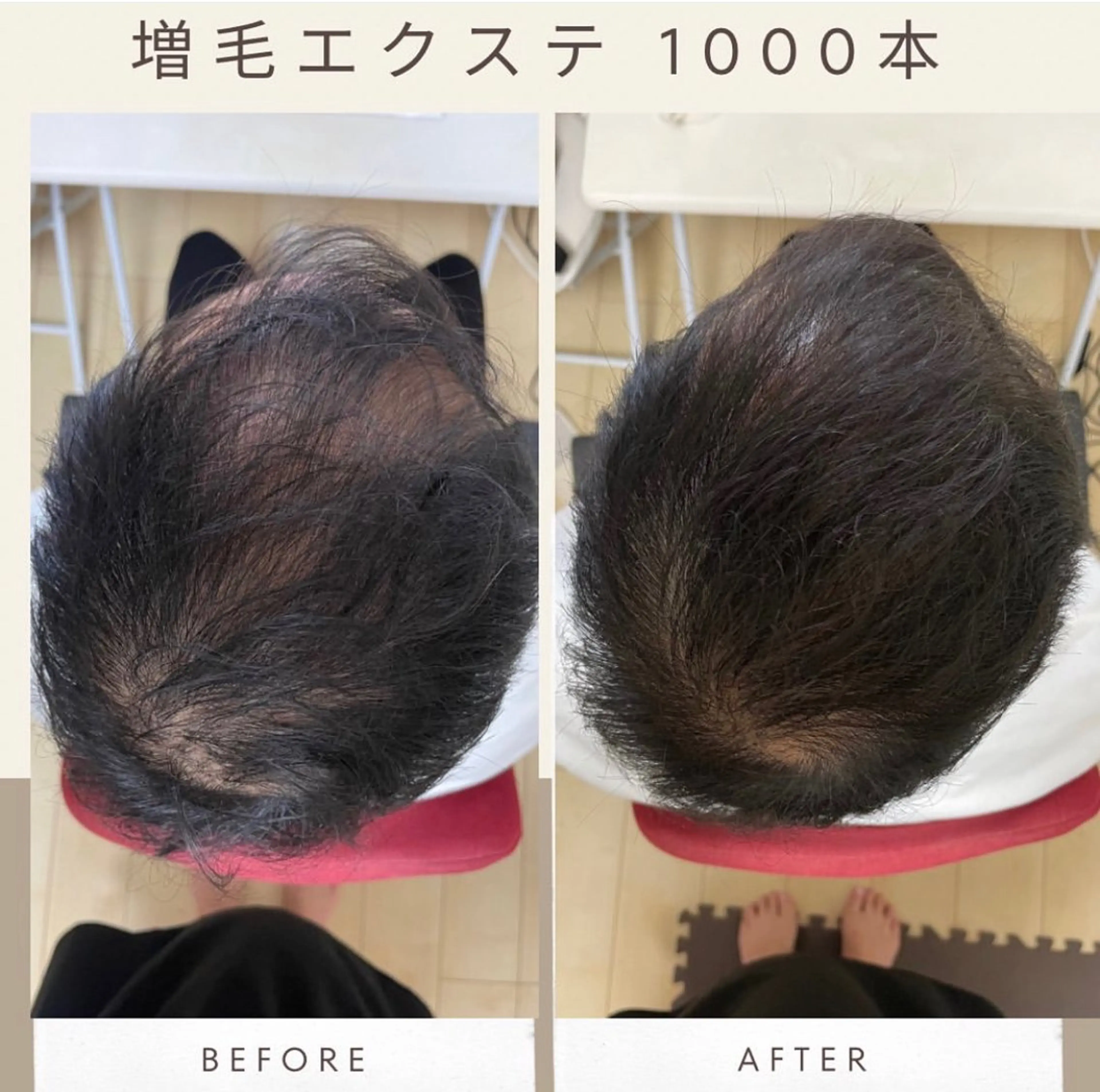 増毛エクステ100本4000円→3200円(90日以内の予約のみ)男性も可の写真