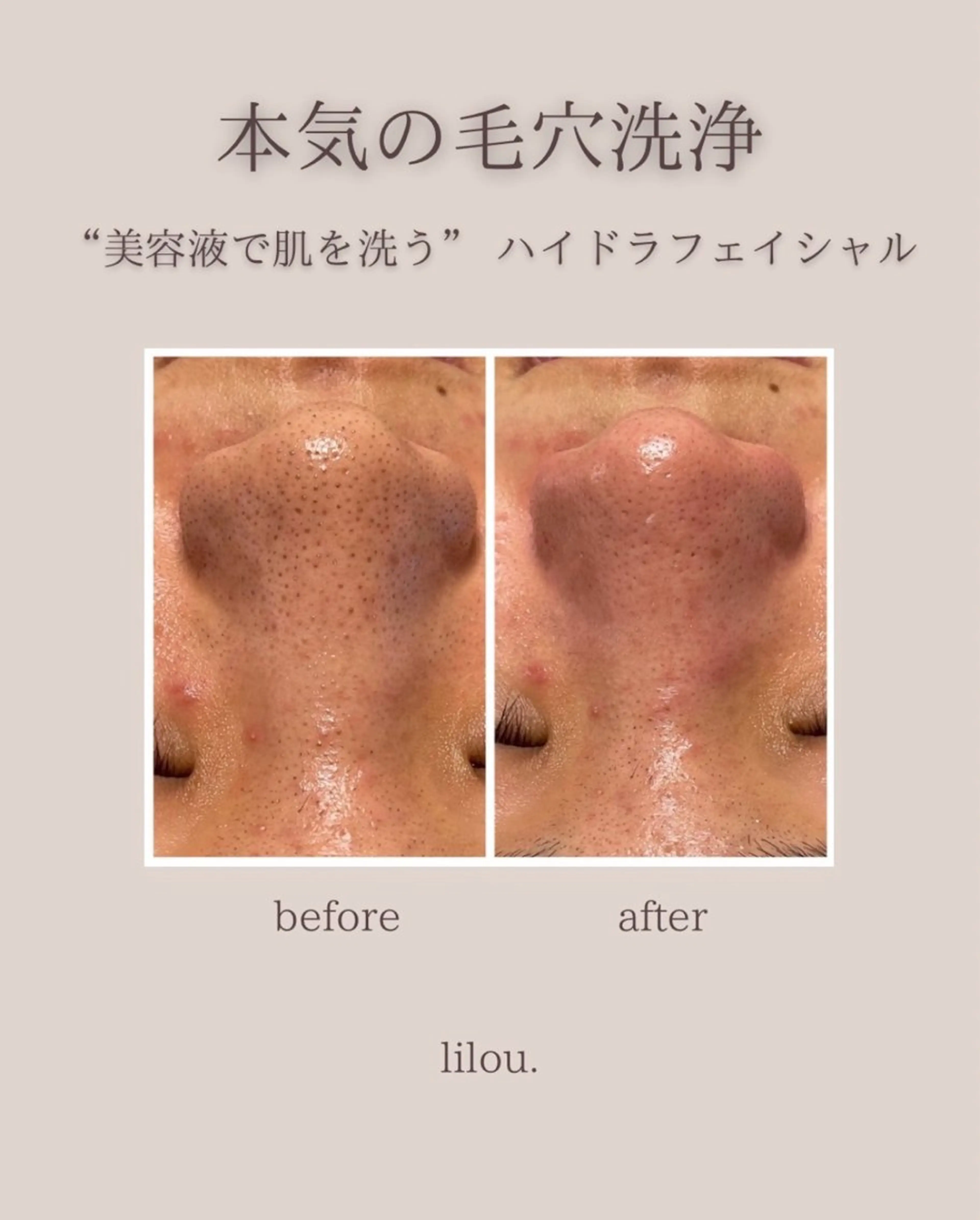 吉田 hue.のエステ・リラクイメージ