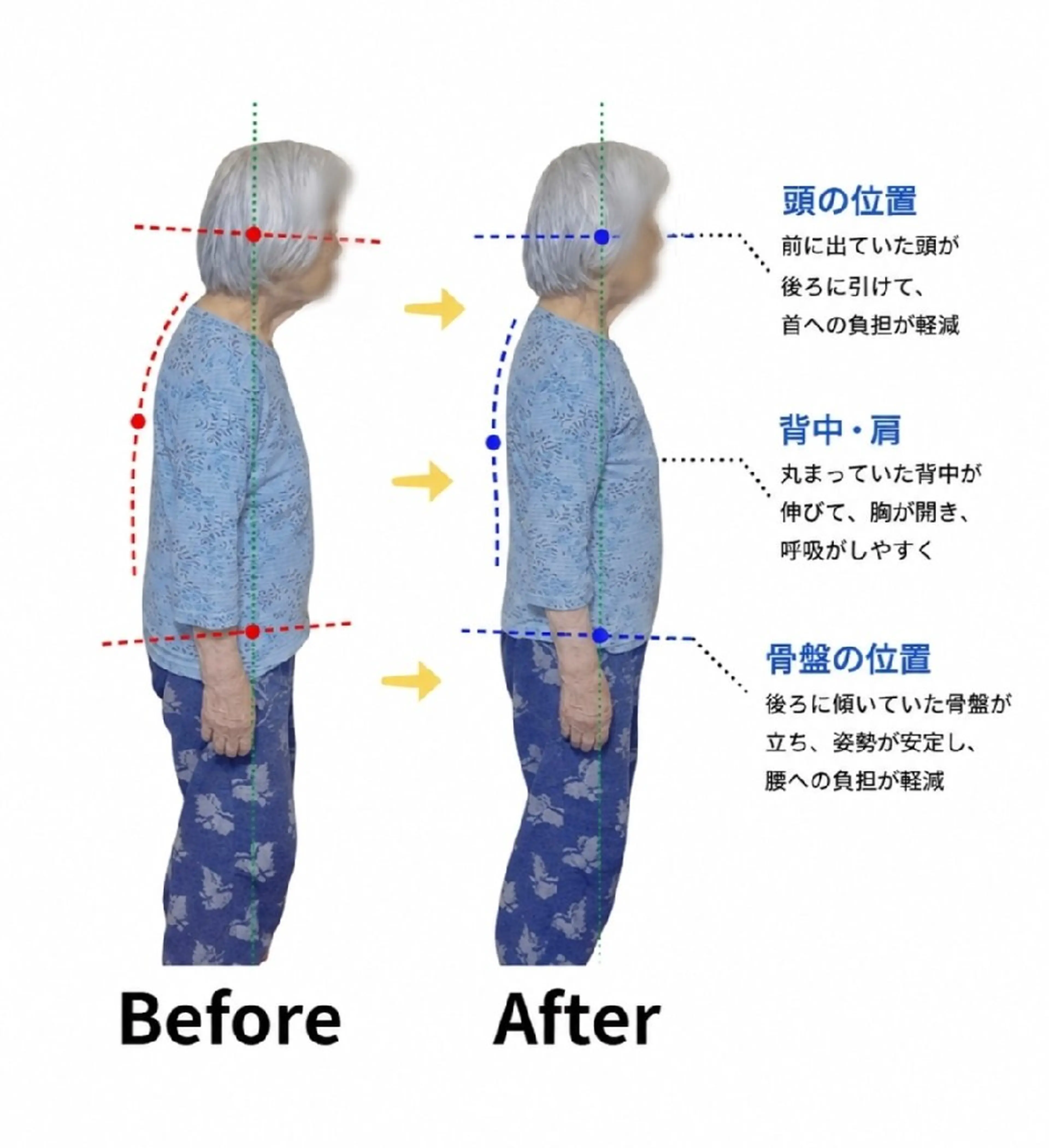 初回限定🌿30分姿勢矯正体験の写真