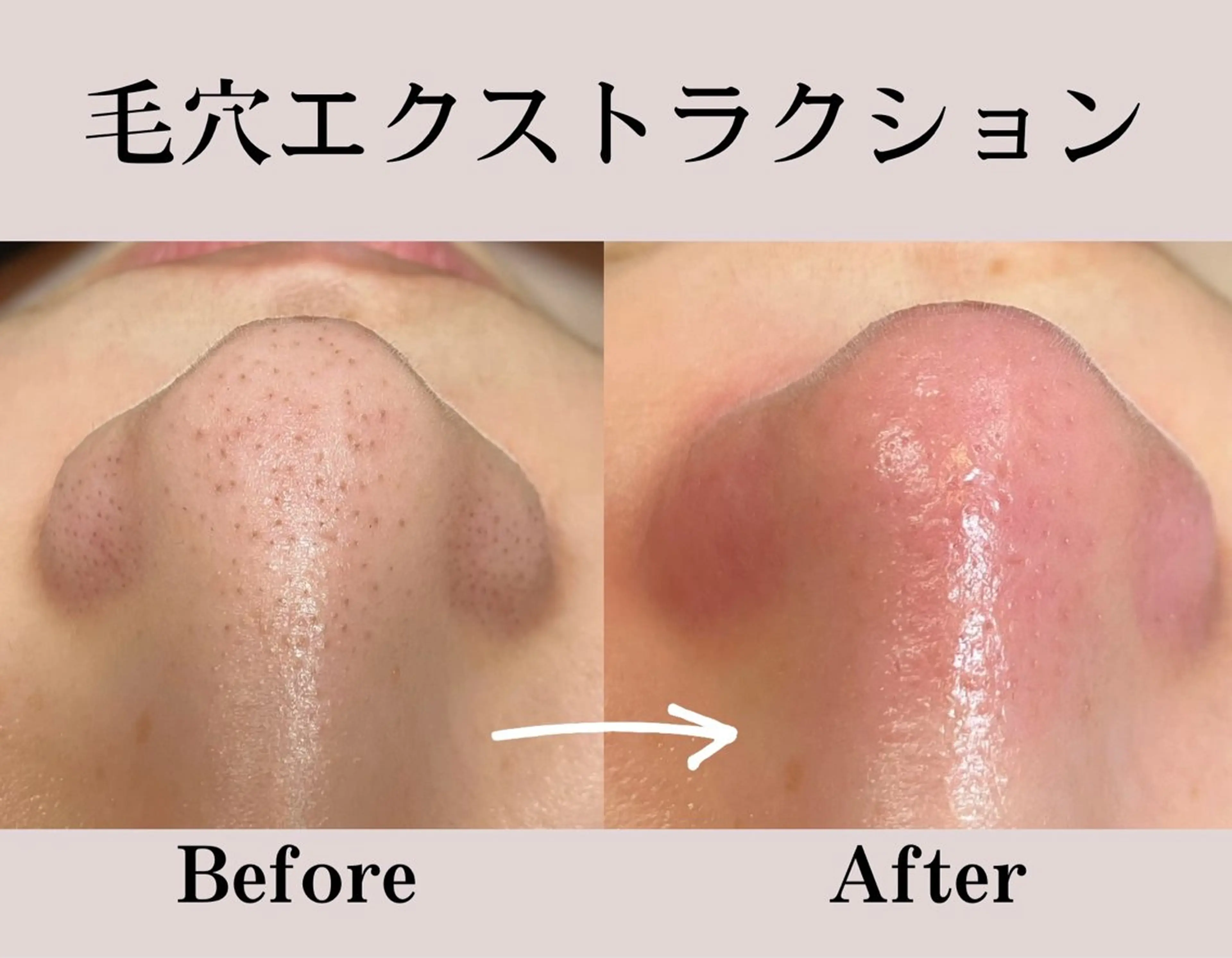 carpe Maraisのヘアスタイル