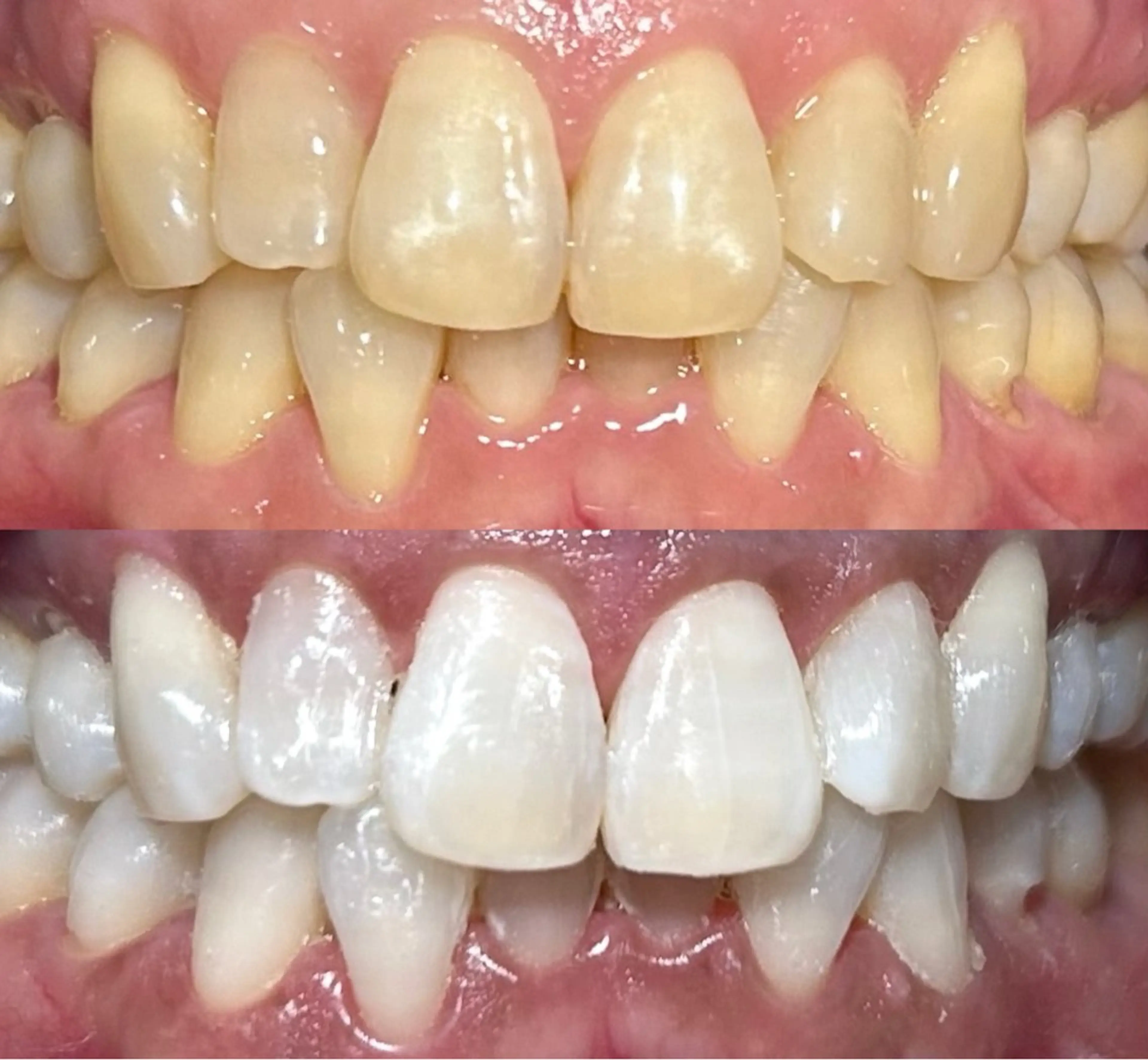 io teeth careのその他イメージ