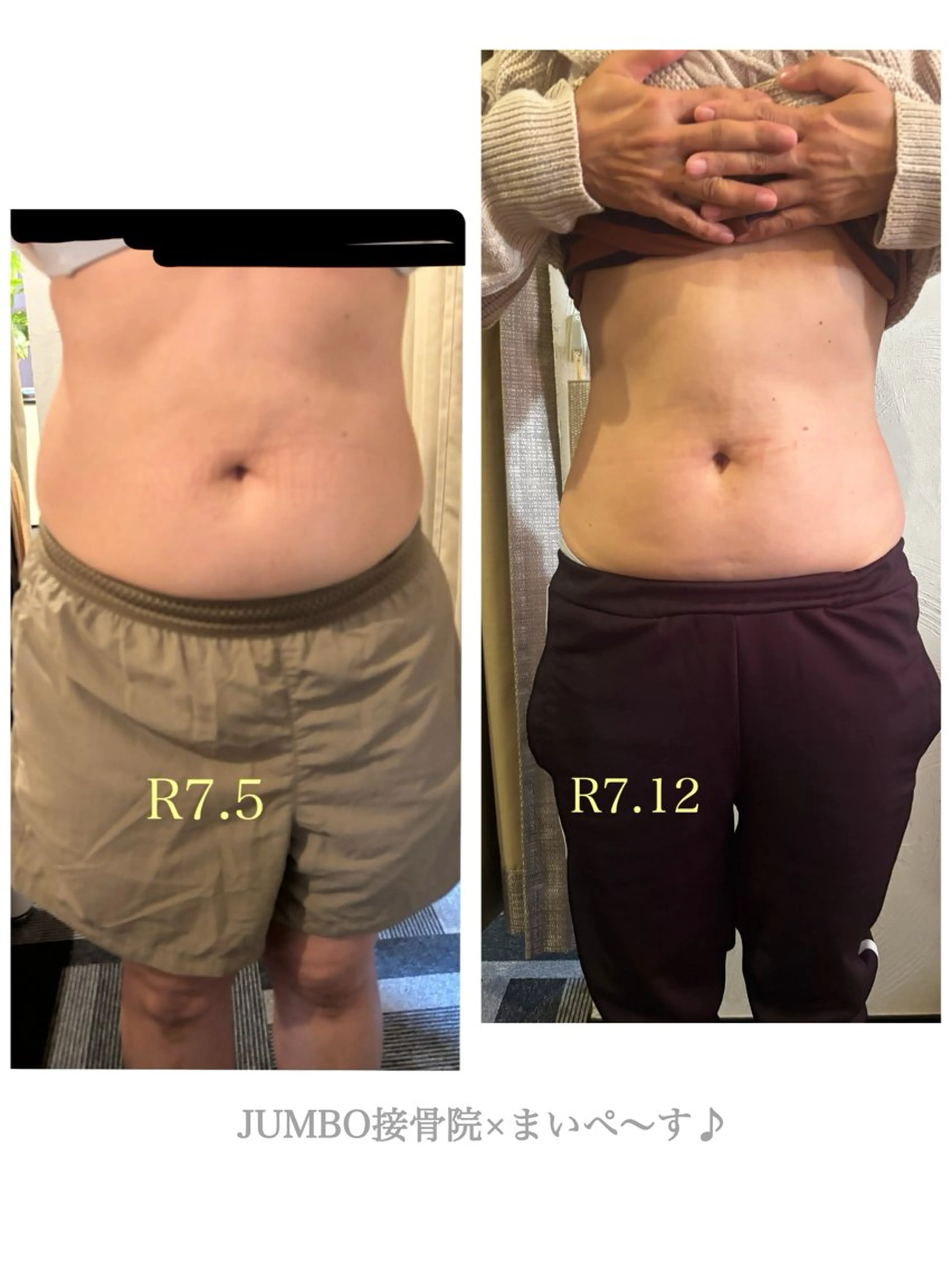 エステ リラク JUMBO接骨院× まいぺ〜す♪のエステ・リラクイメージ