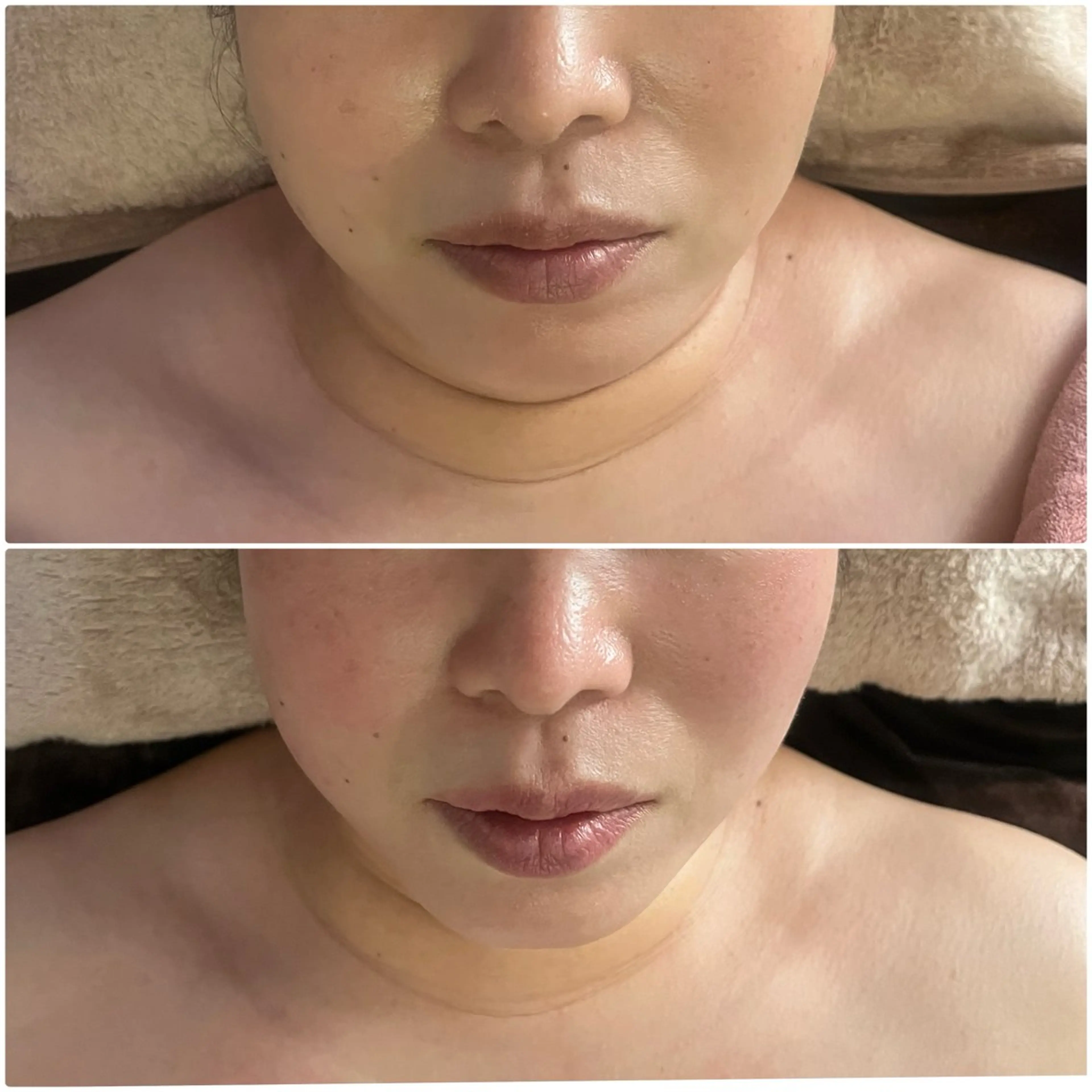 エステ アロマ･美容鍼･カッ ピング「麗」鍼灸院のエステ・リラクイメージ