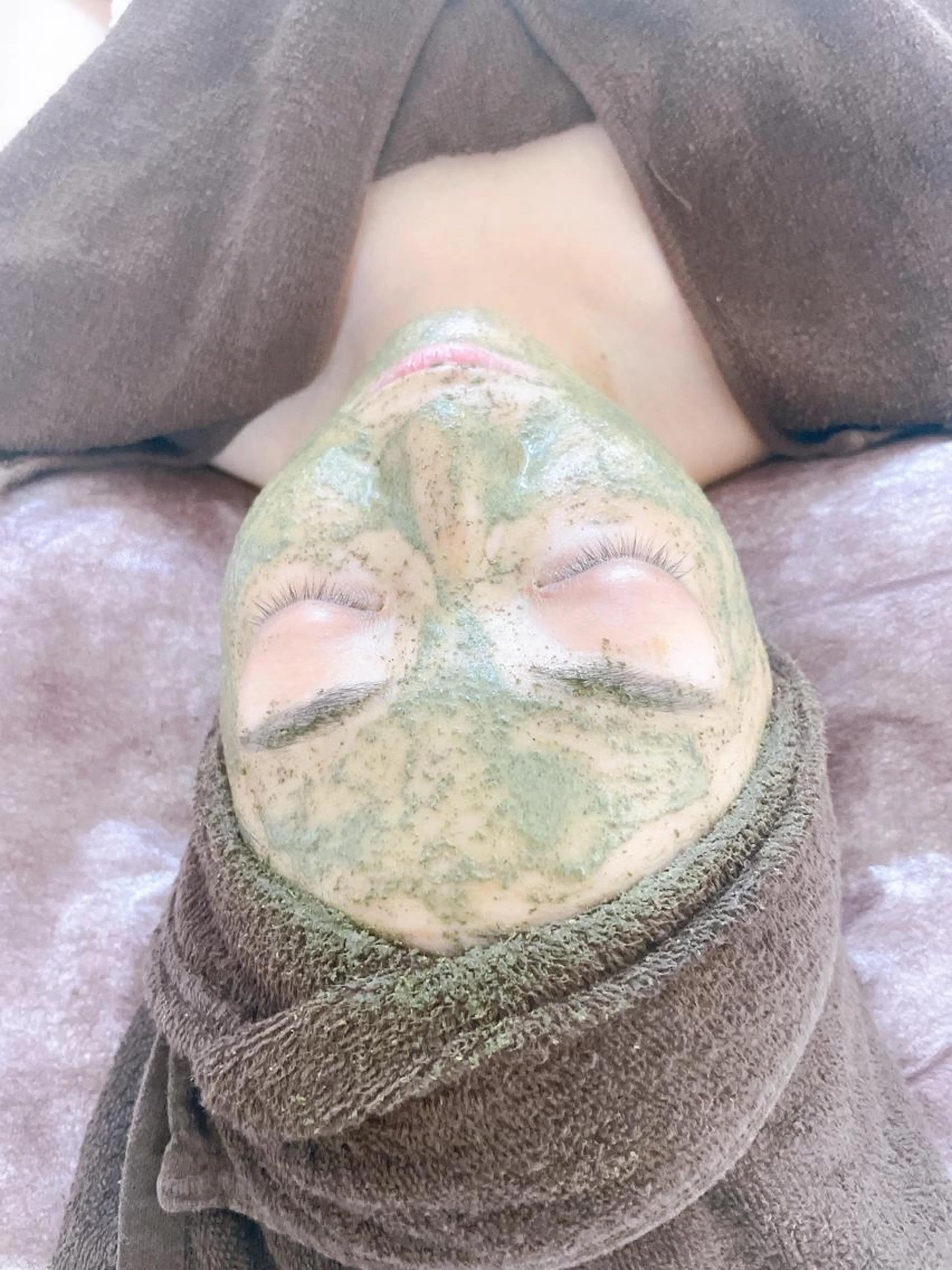 【剥けないハーブピーリング】美容液オプションは当日相談の写真