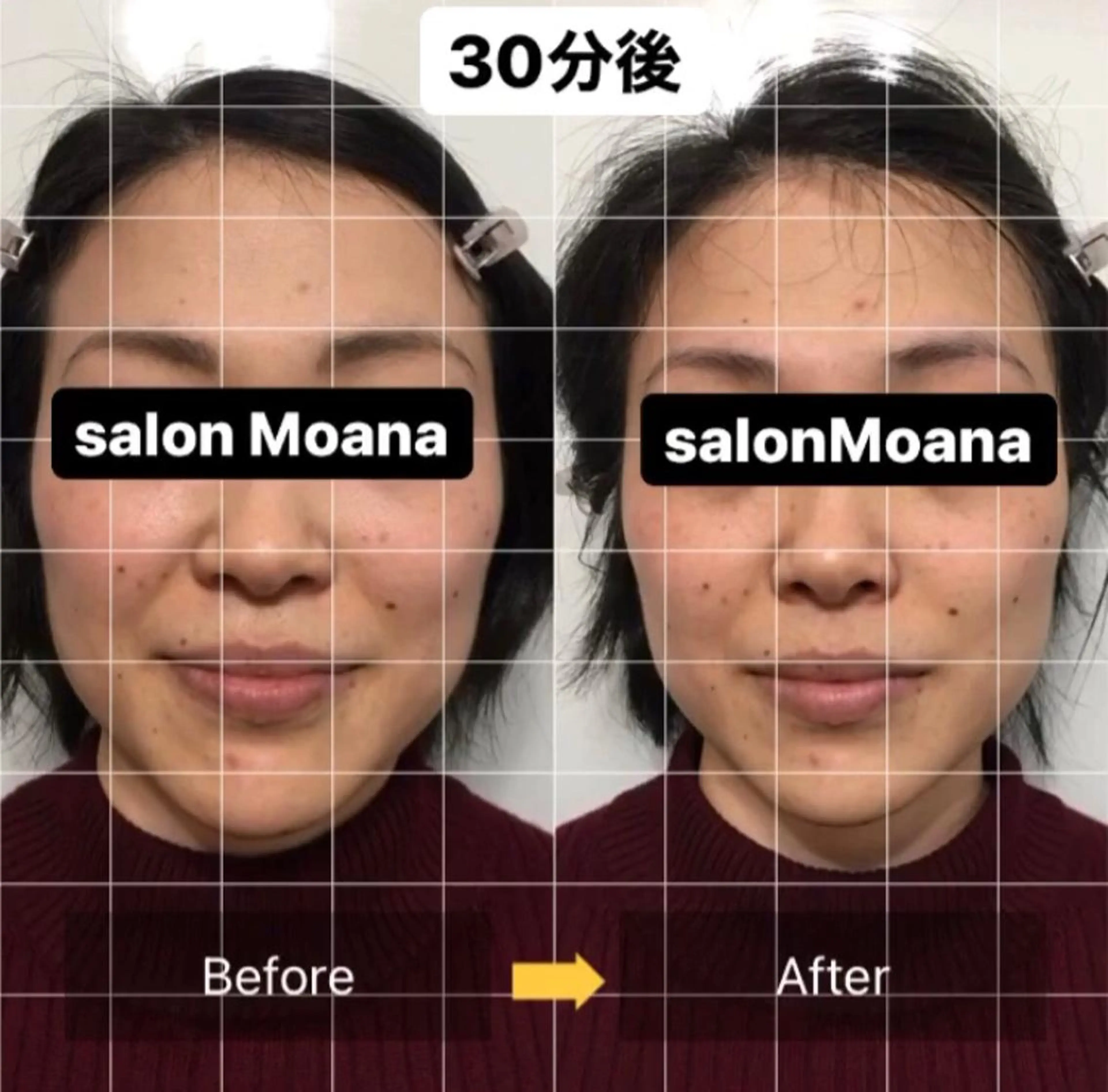 小顔美肌salon MOANAのエステ・リラクイメージ