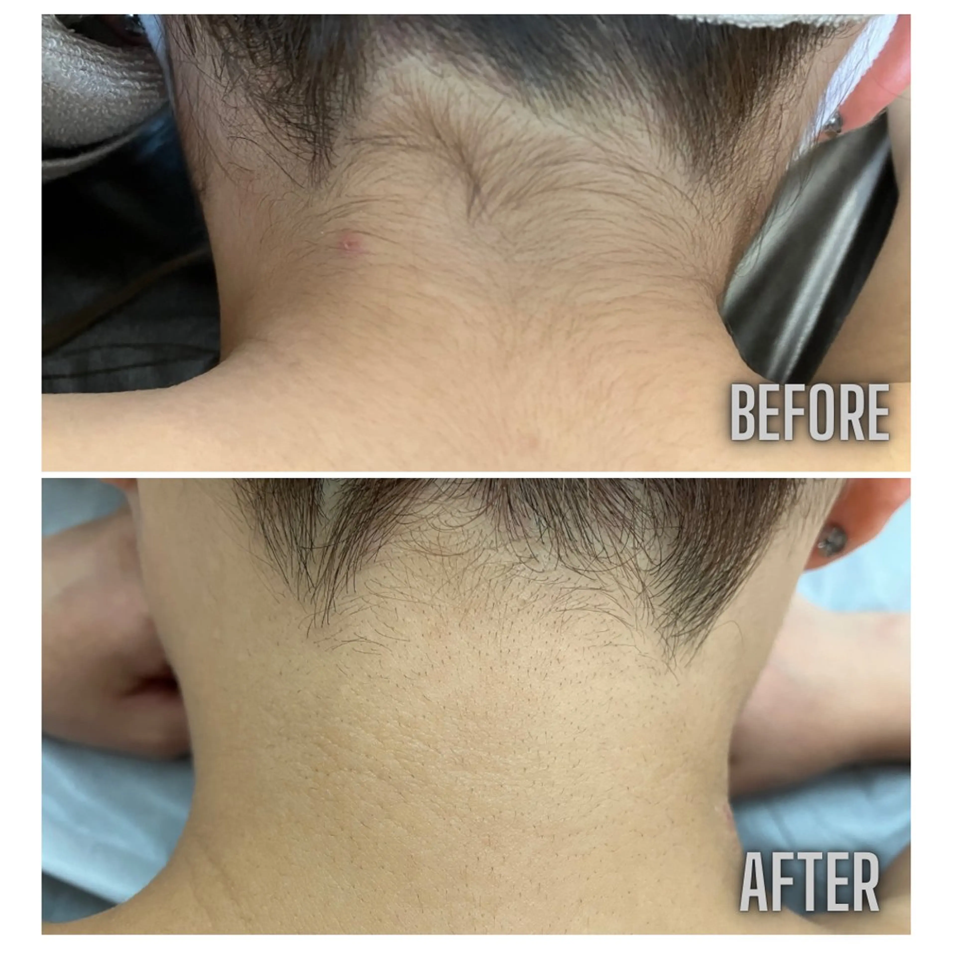 ショート メンズ 古々本 明歩のエステ・リラクイメージ