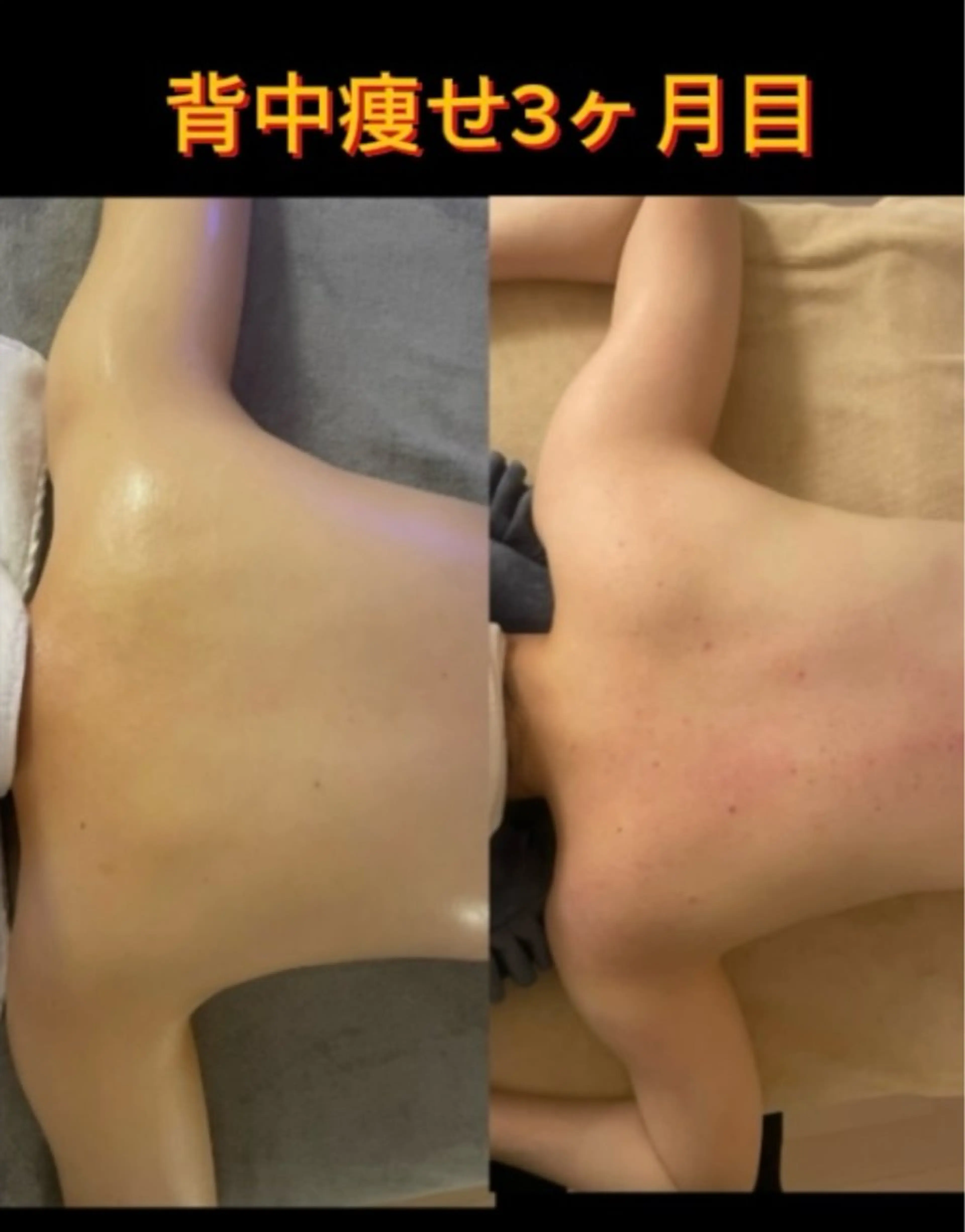 エステ M 🌱naturalのエステ・リラクイメージ