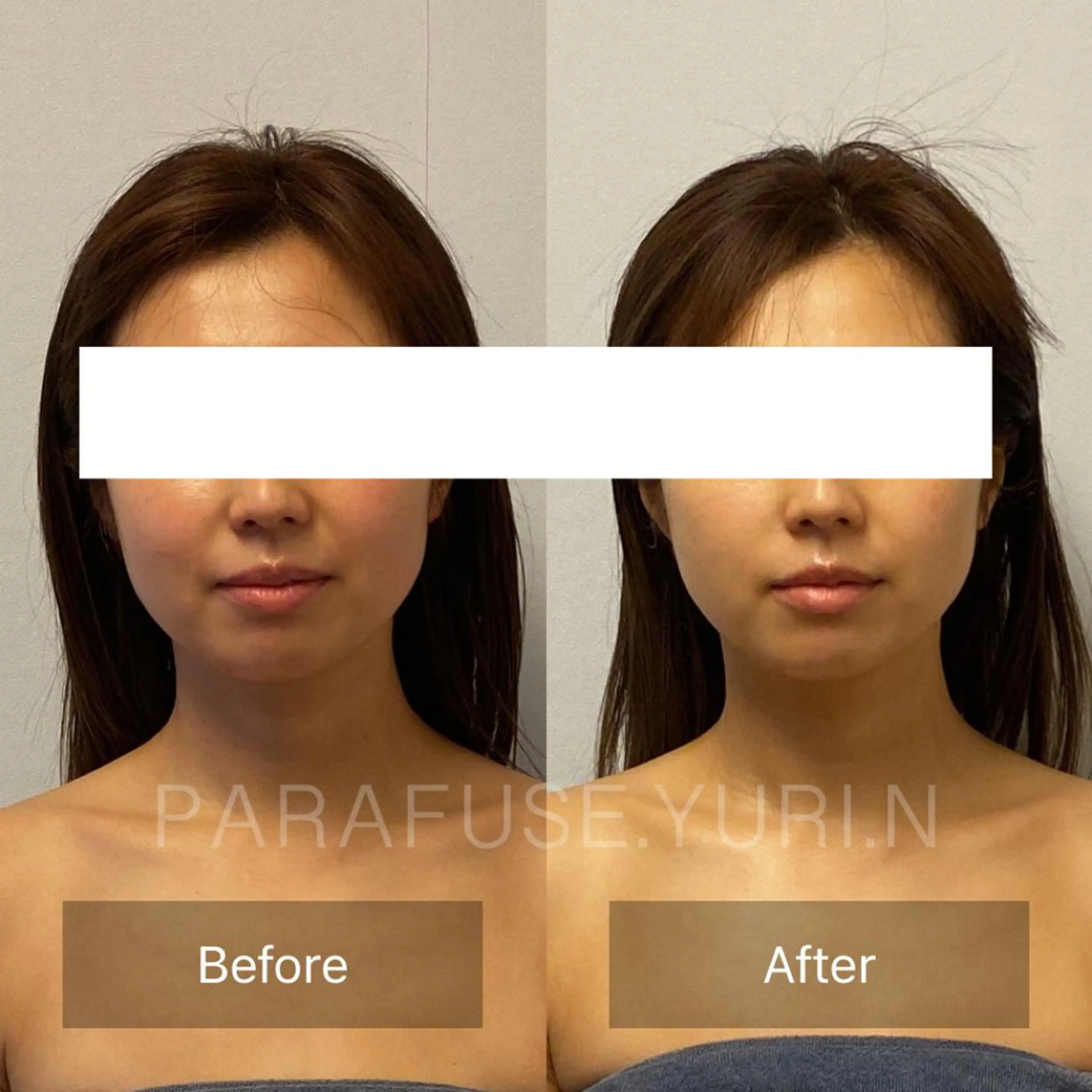 エステ リラク onnitete所属・onnitete PARAFUSEのエステ・リラクイメージ