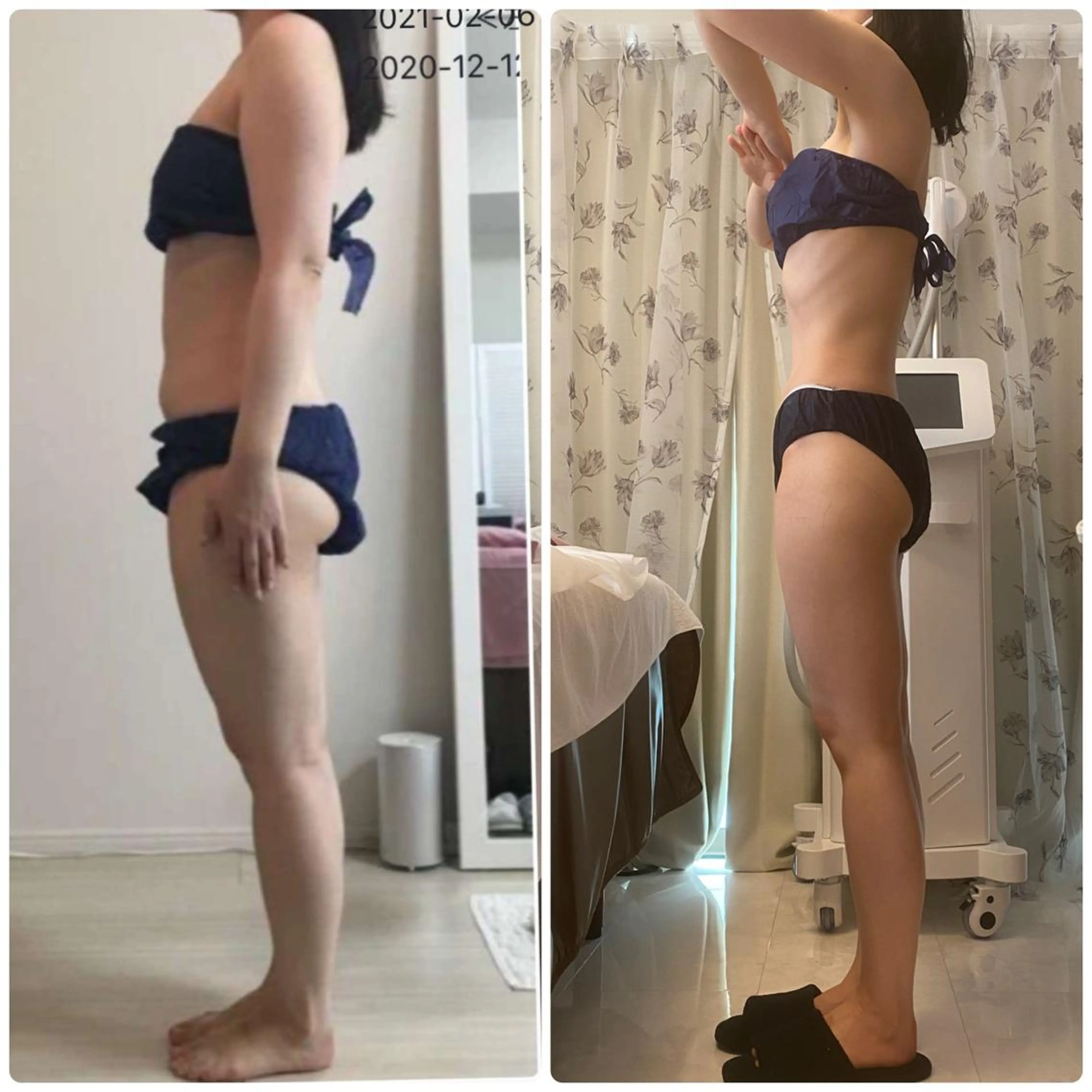 エステ 綺麗のひみつ グランプリ受賞店のエステ・リラクイメージ