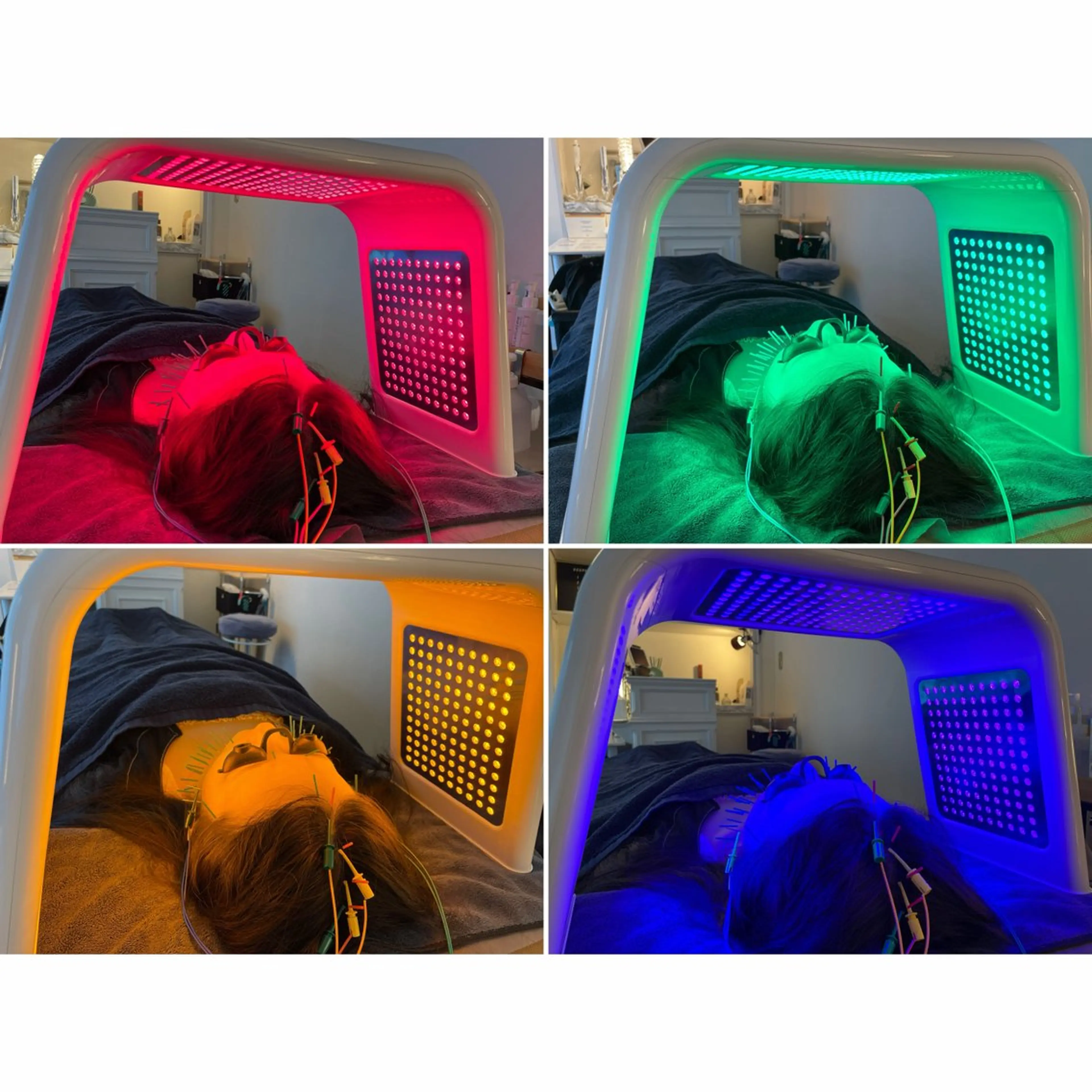 【SALE】【毛穴・赤み・くすみケア】光美容LED×美容鍼 60分の写真