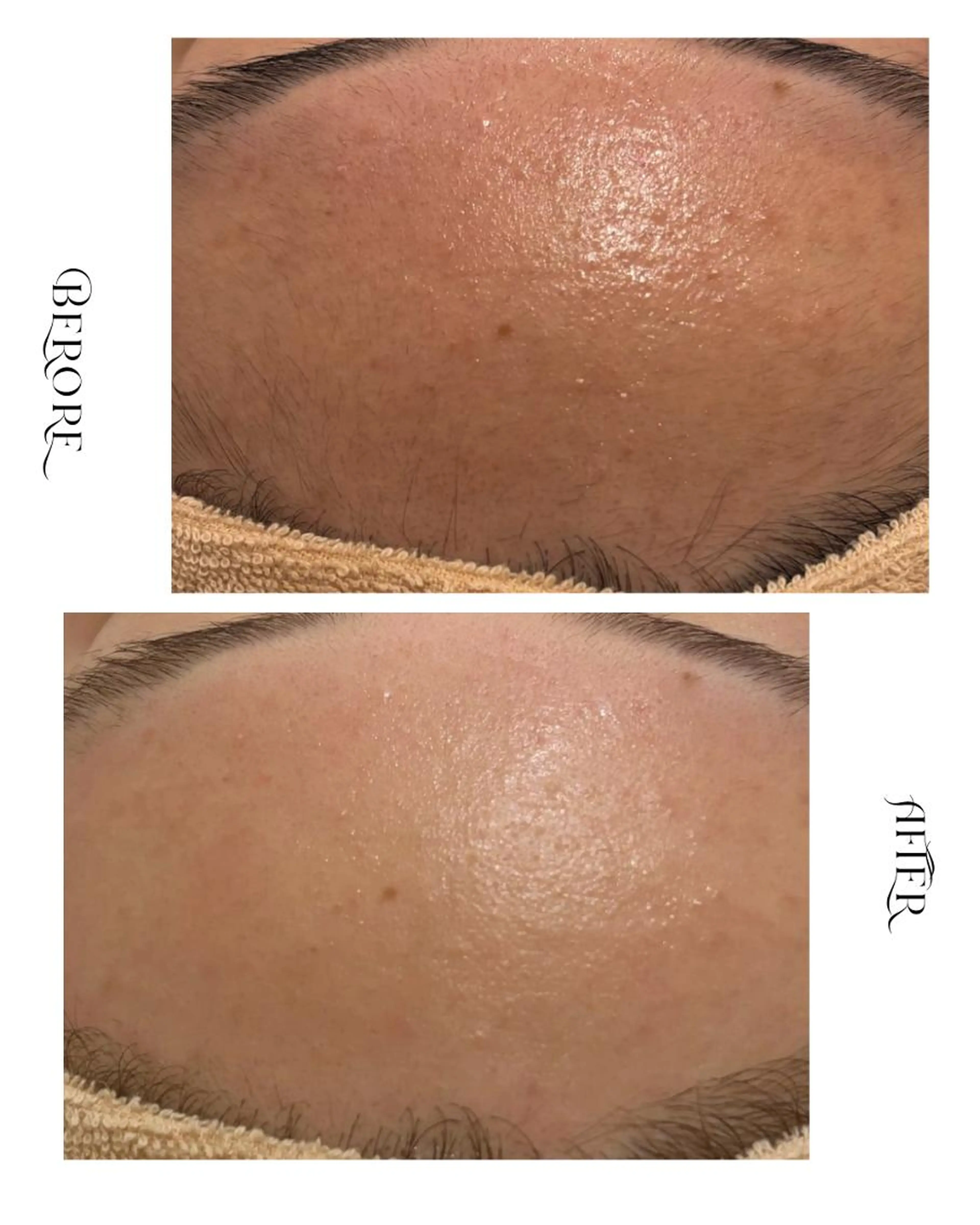 《ツヤ｜化粧ノリUP》艶肌ワックス＋光脱毛の写真