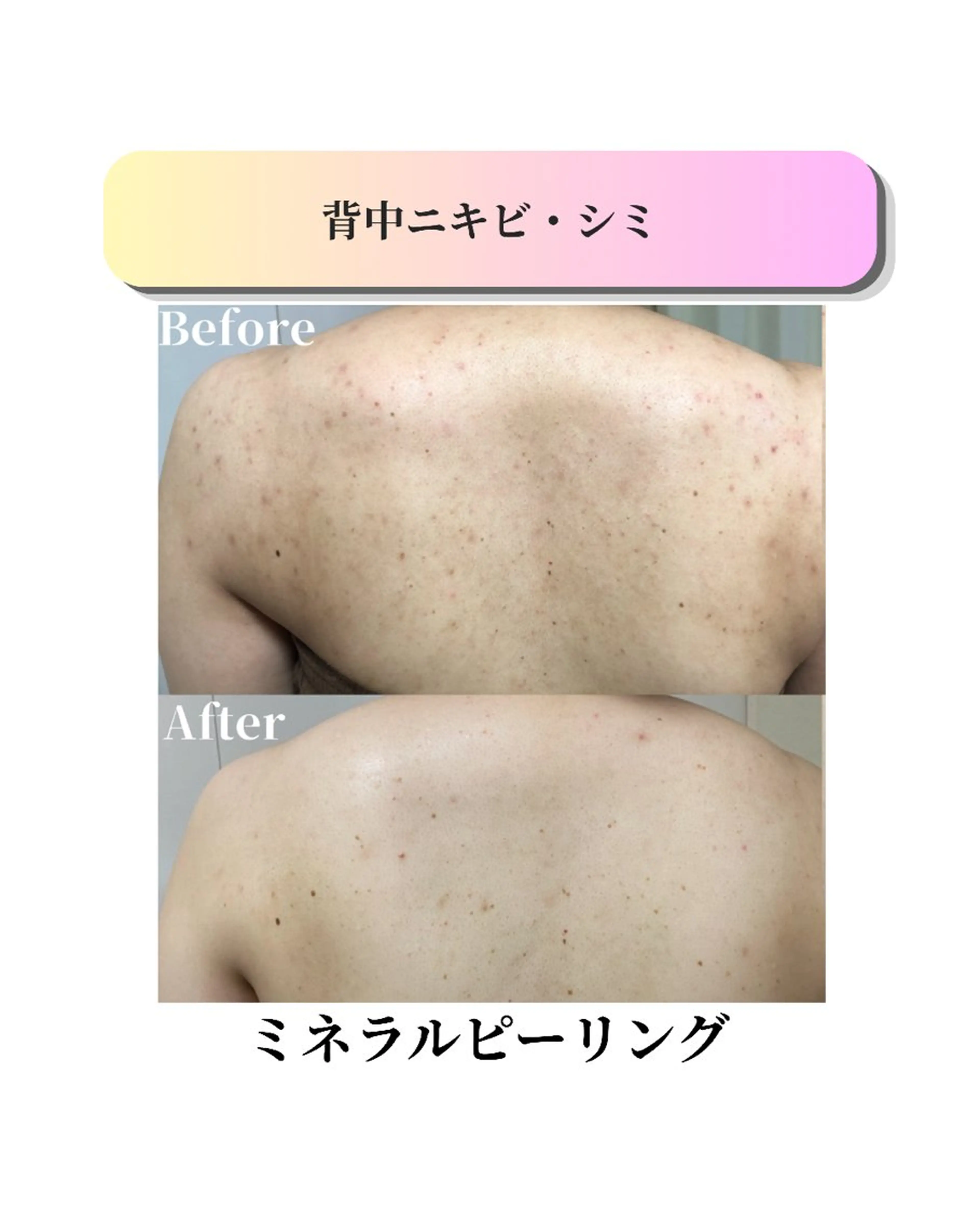 エステ ローズフィールド 森岡朋美のエステ・リラクイメージ