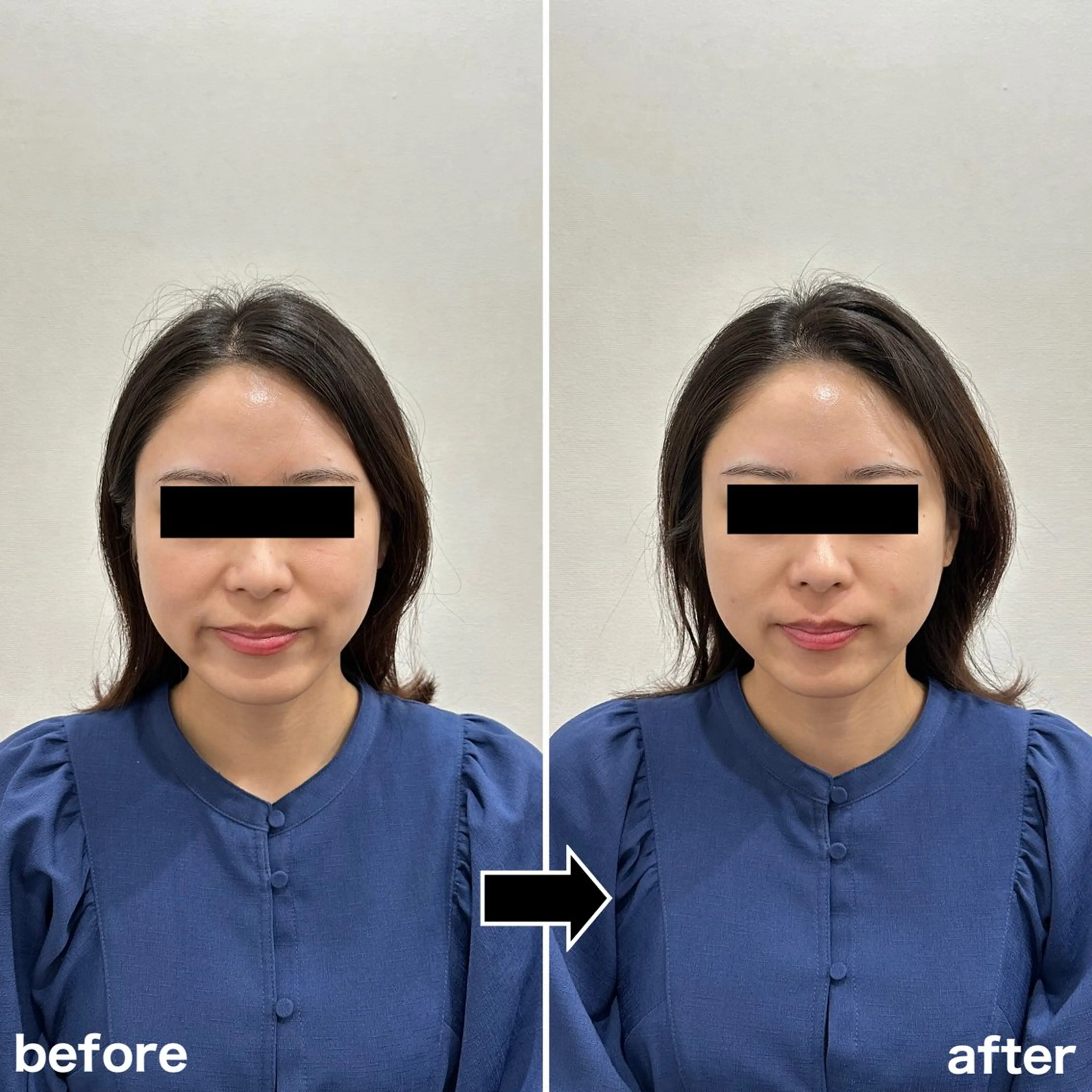 エステ リラク 小顔矯正・美容鍼 FLOW鍼灸整体院のエステ・リラクイメージ