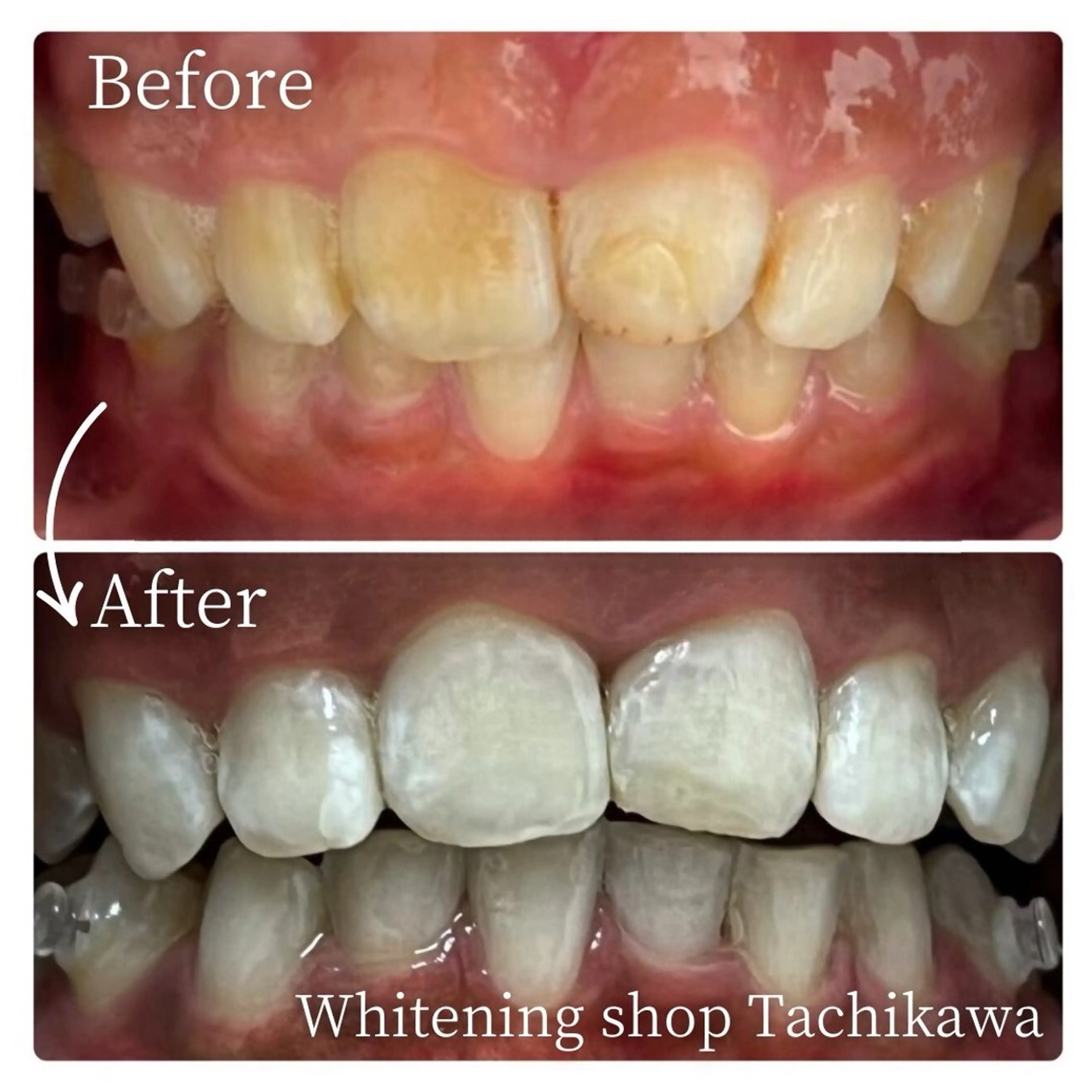 セルフ ホワイト ニングショップ立川のその他イメージ