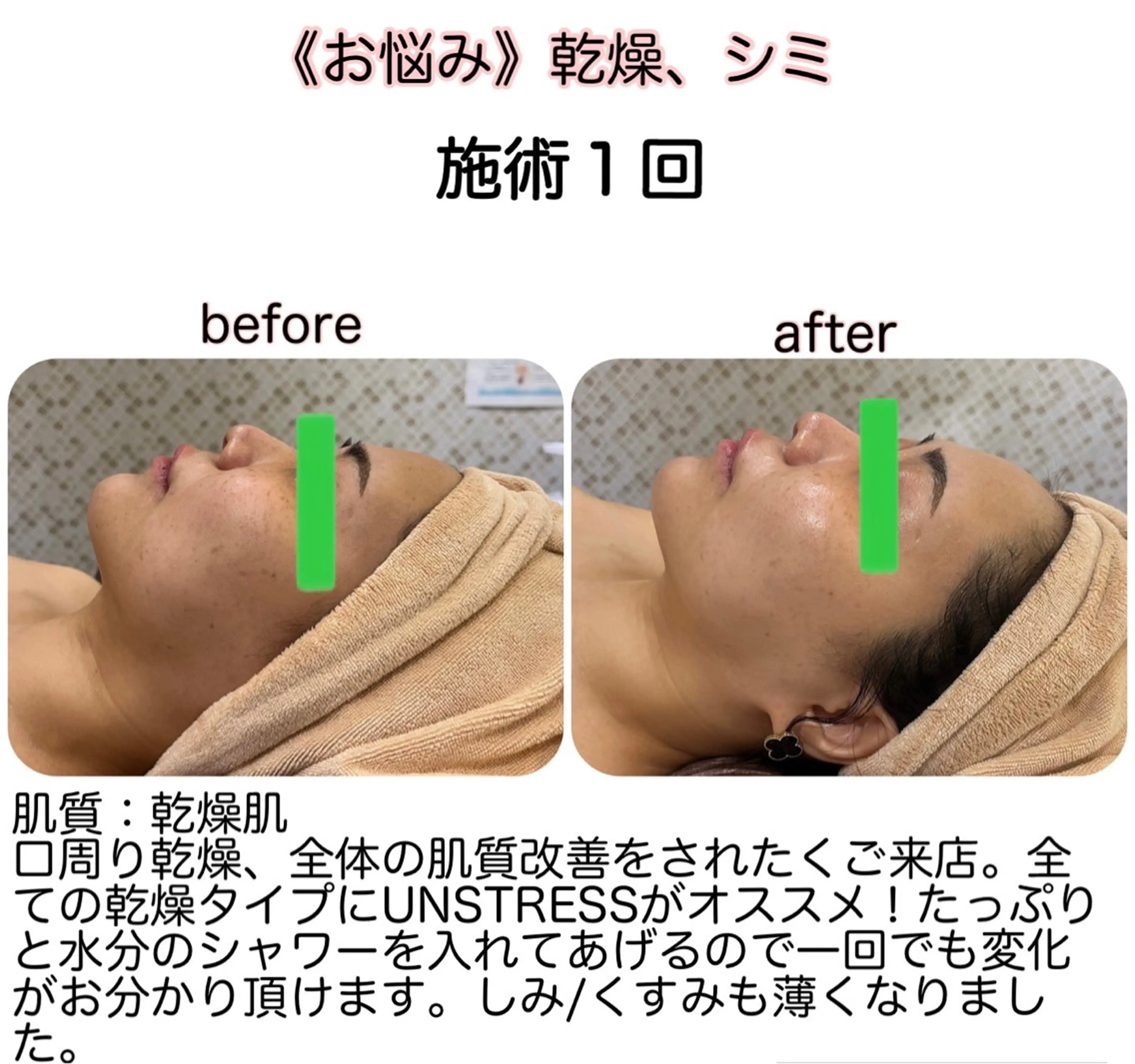 小顔&美肌品川店 Masqueradeのエステ・リラクイメージ